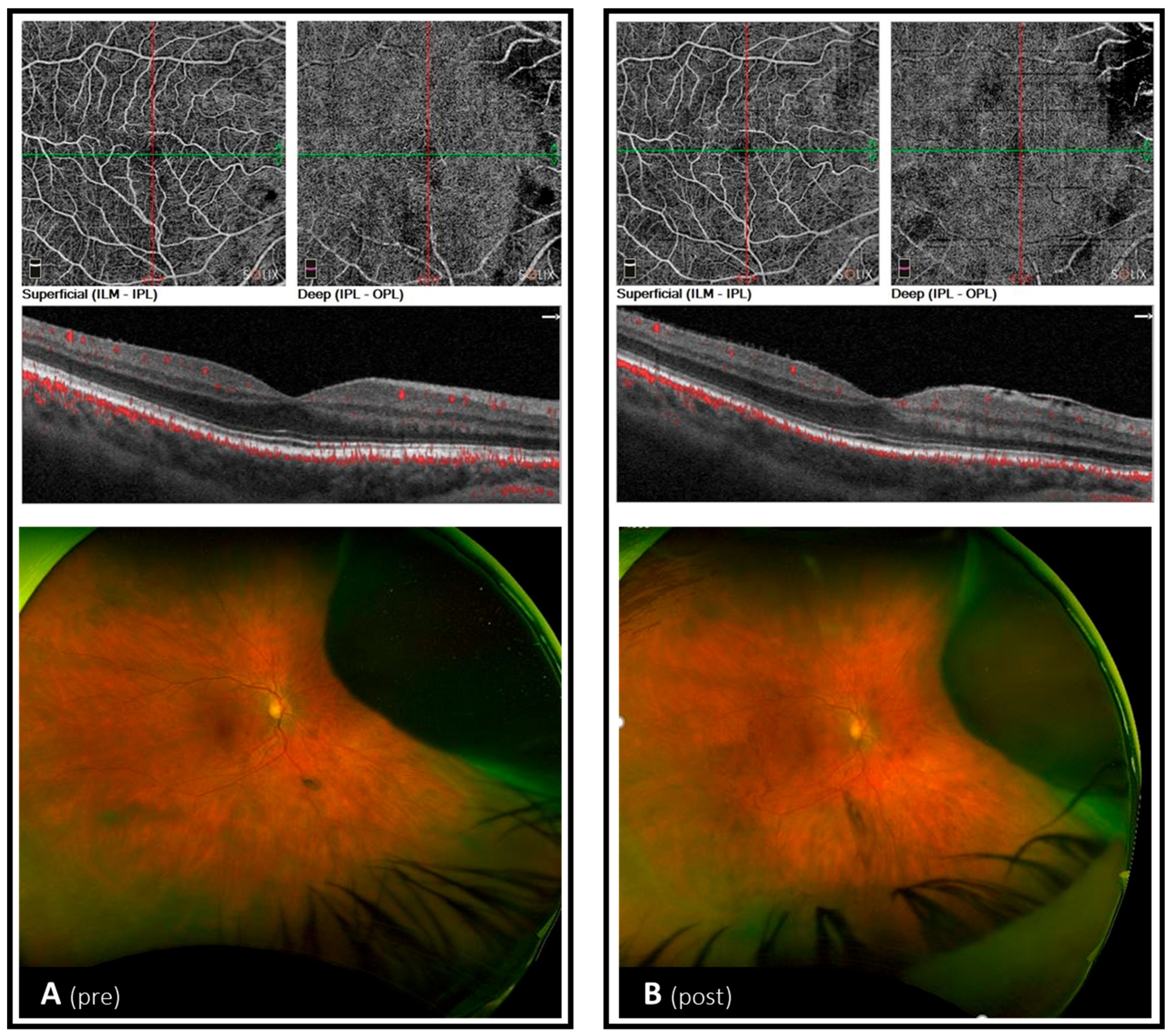 Reports 08 00260 g0a1 Reports 08 00260 g0a1