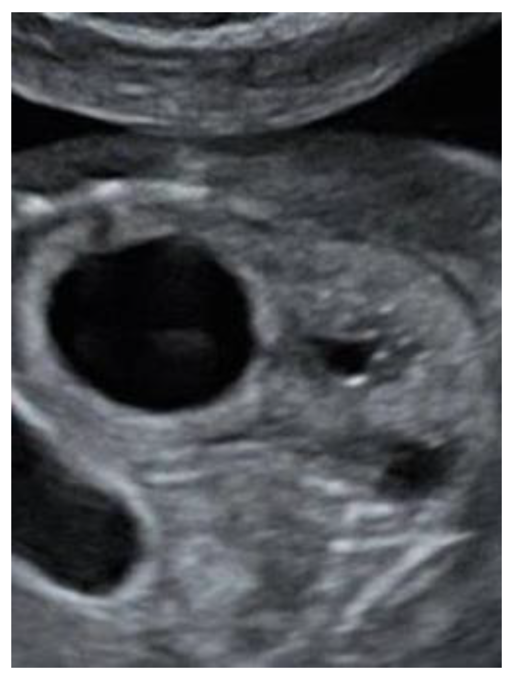 Reprodmed 02 00012 g005 550