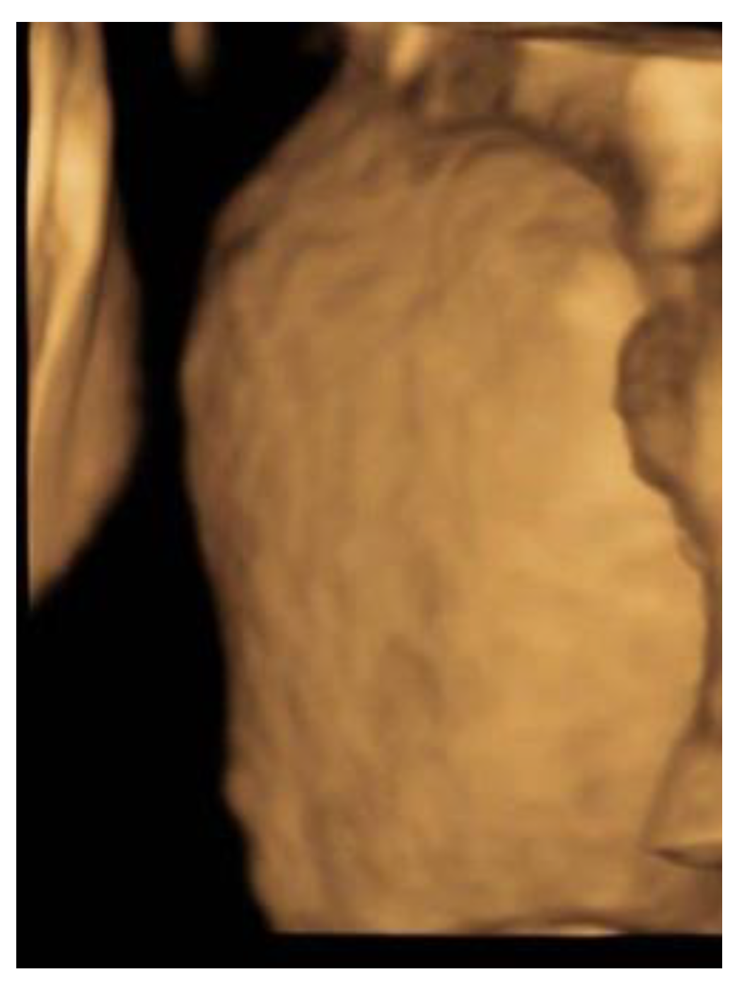 Reprodmed 02 00012 g006 550