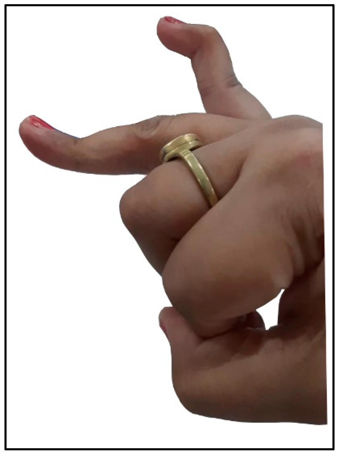 Rheumato 03 00004 g001