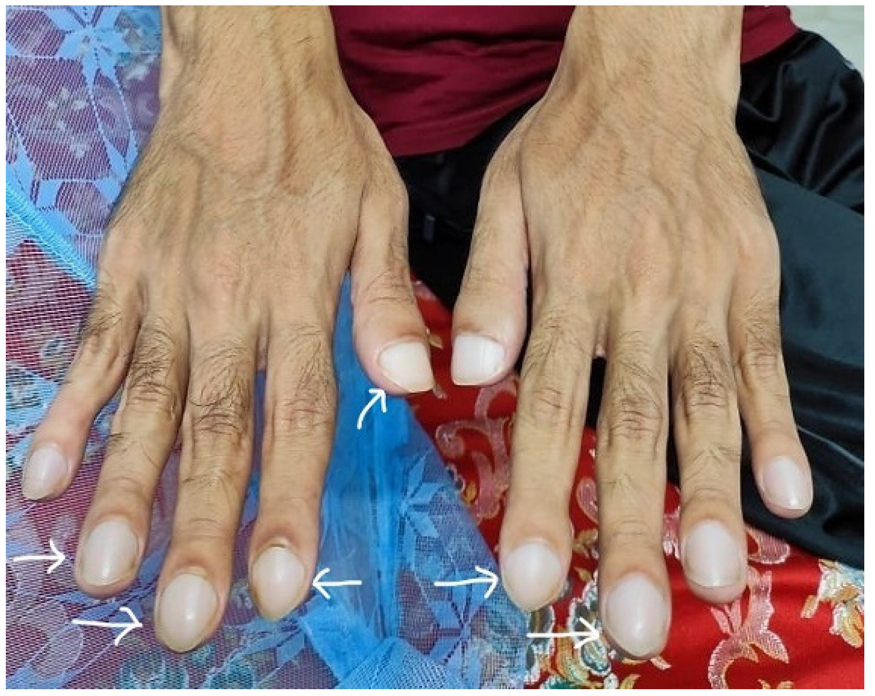 Rheumato 03 00008 g002