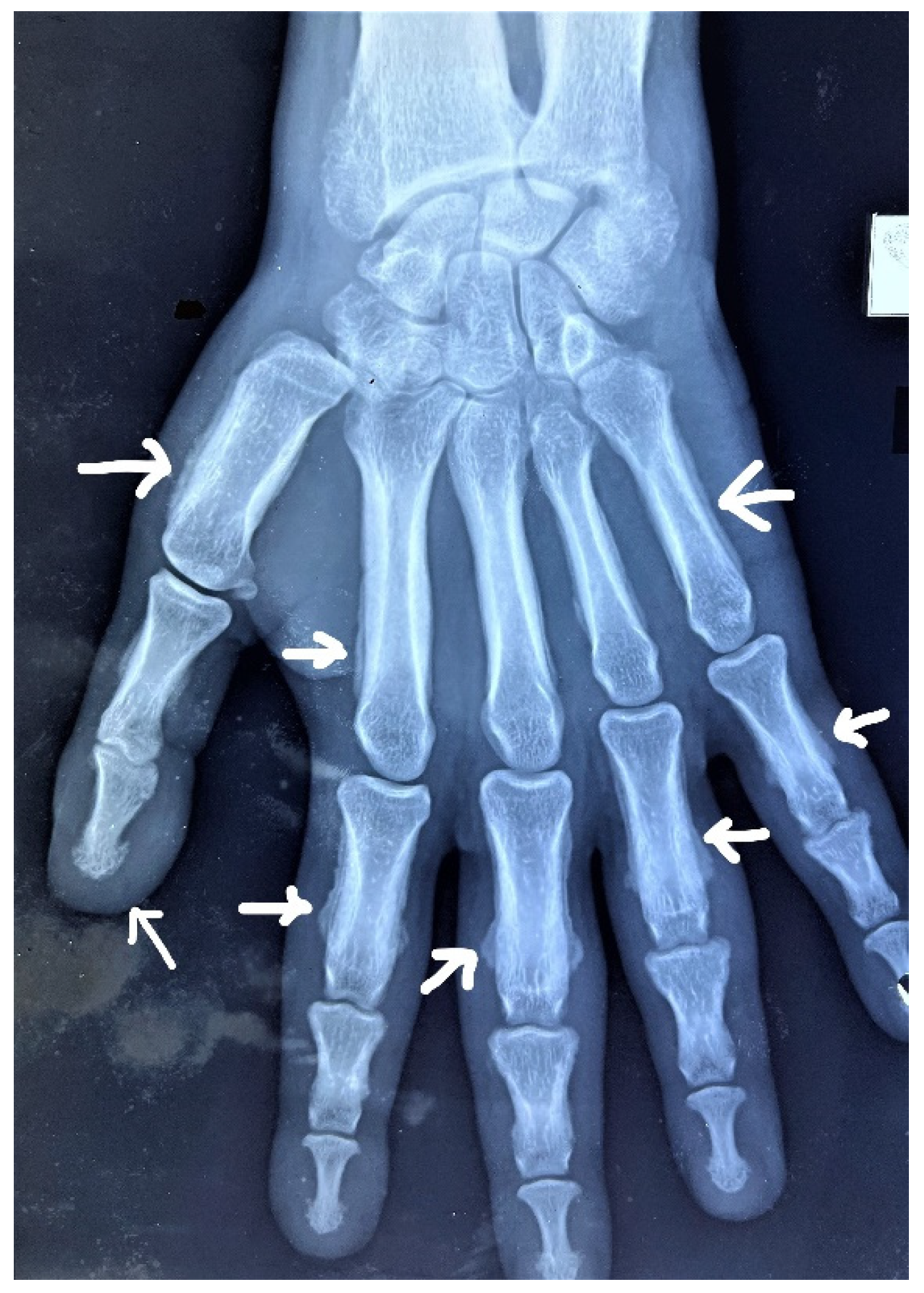 Rheumato 03 00008 g004