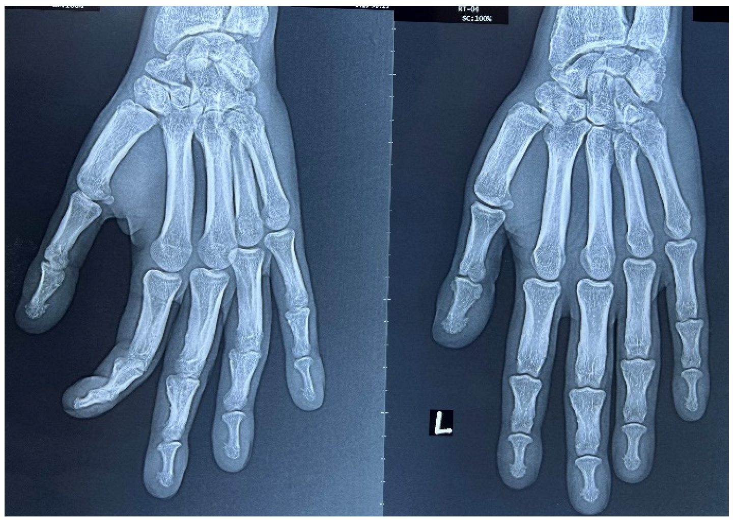 Rheumato 03 00008 g006