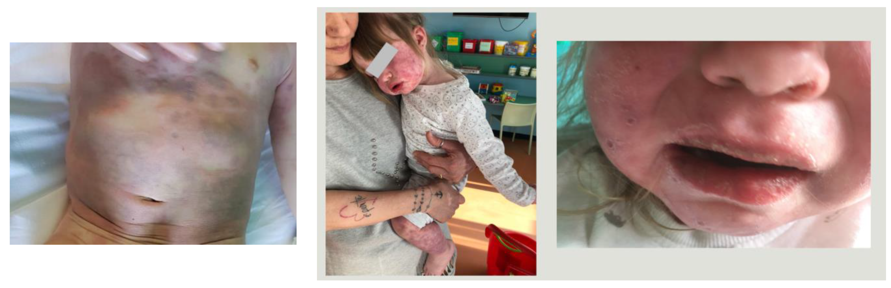 Rheumato 03 00015 g001