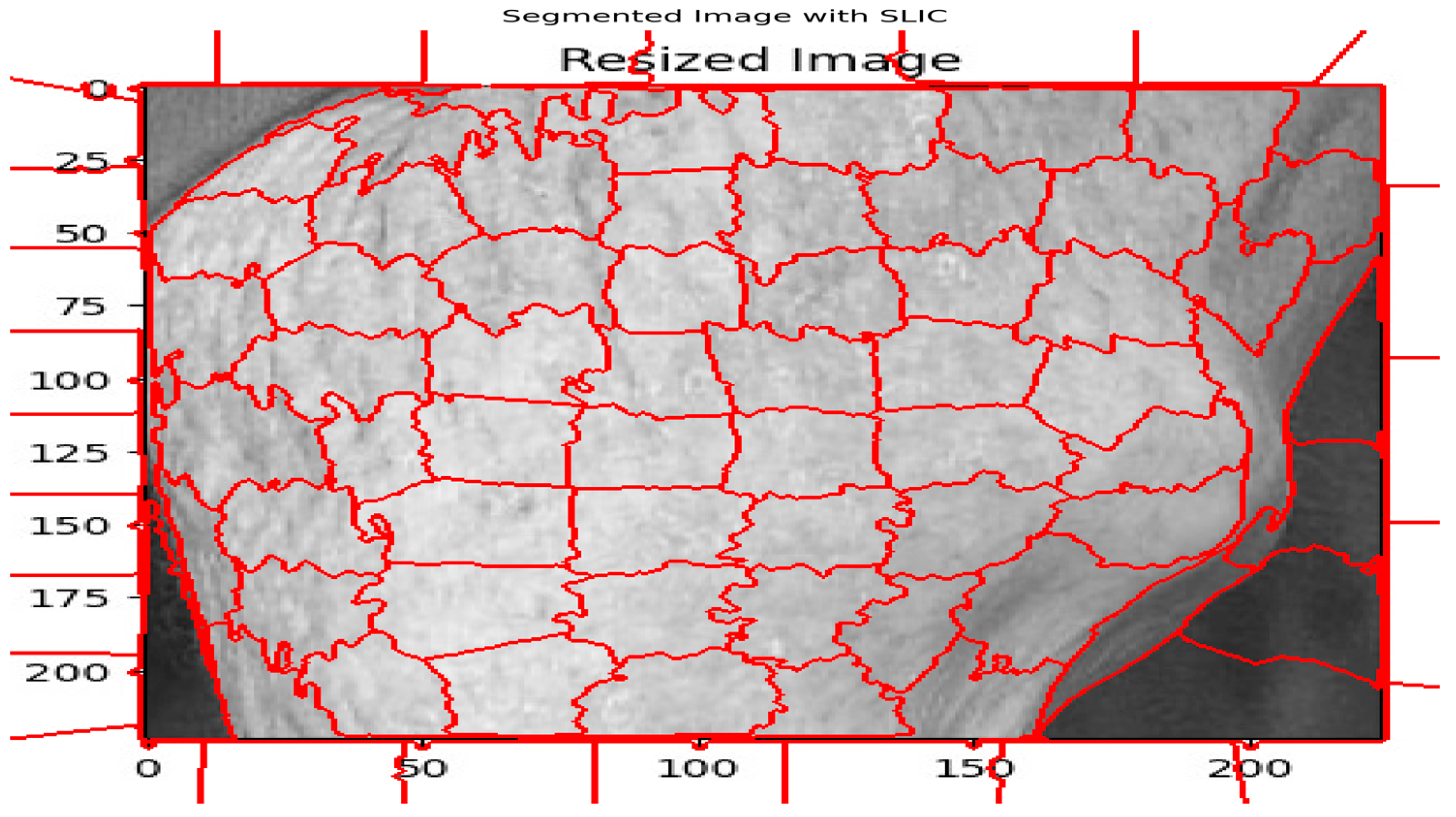 Rheumato 04 00014 g004