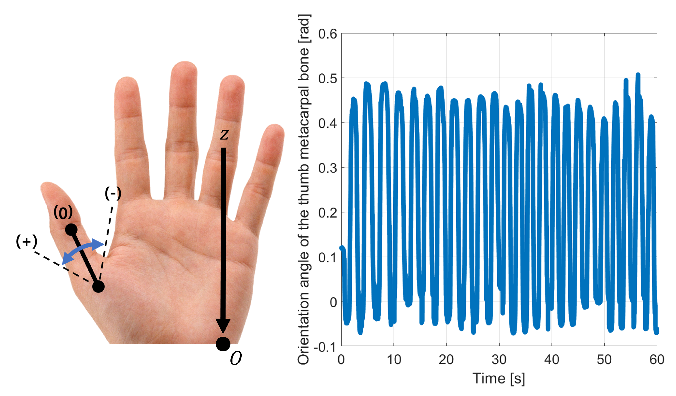 Robotics Free Full Text Displacement Analysis And Design Of A 2 Rru Urr Parallel Mechanism Performing 2r1t Output Motion For Thumb Rehabilitation Html