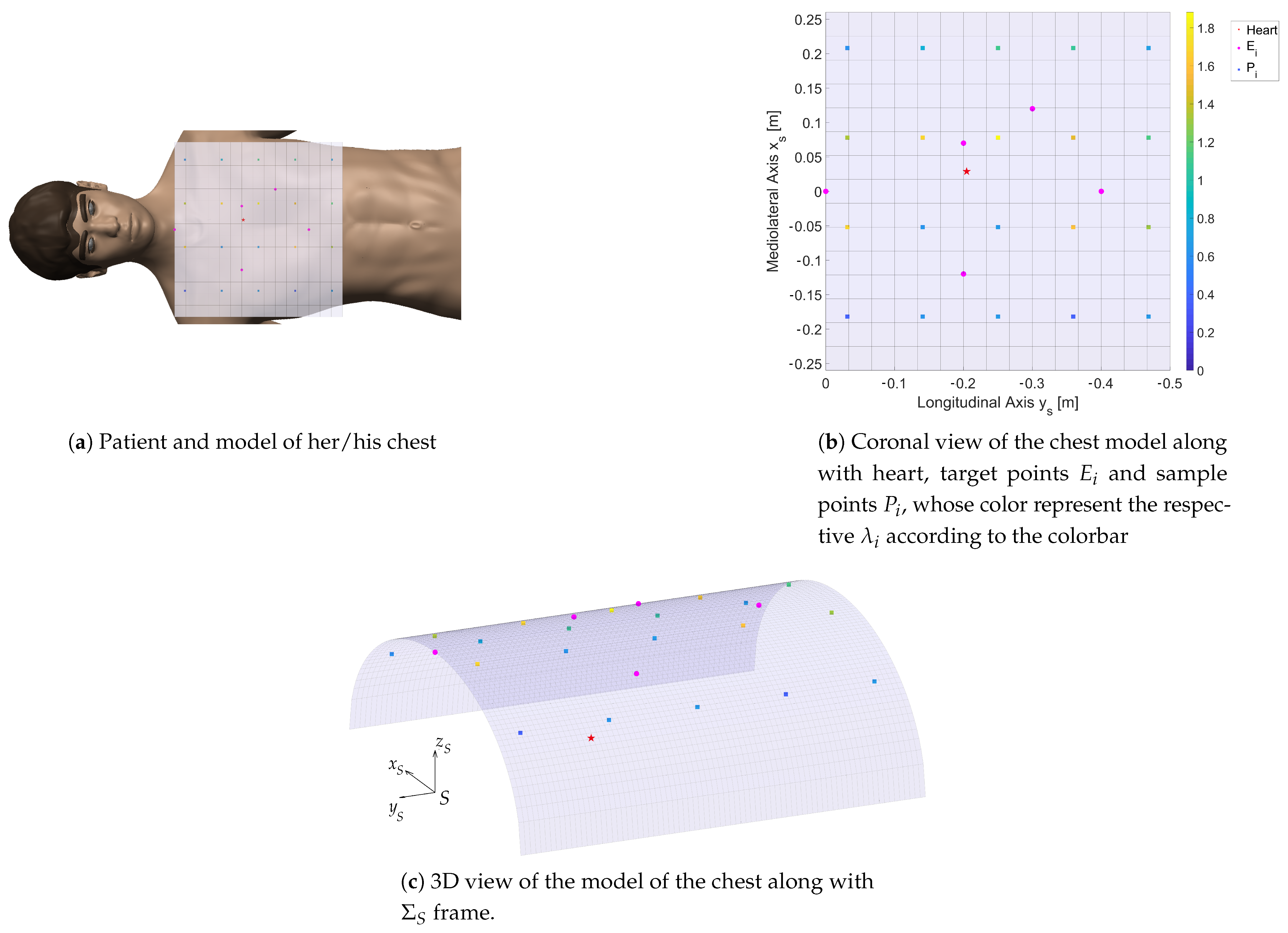 Robotics | Free Full-Text | Kinematic Optimization for the Design of a Collaborative Robot End-Effector for Tele-Echography | HTML Robotics | Free Full-Text | Kinematic Optimization for the Design of a Collaborative Robot End-Effector for Tele-Echography | HTML