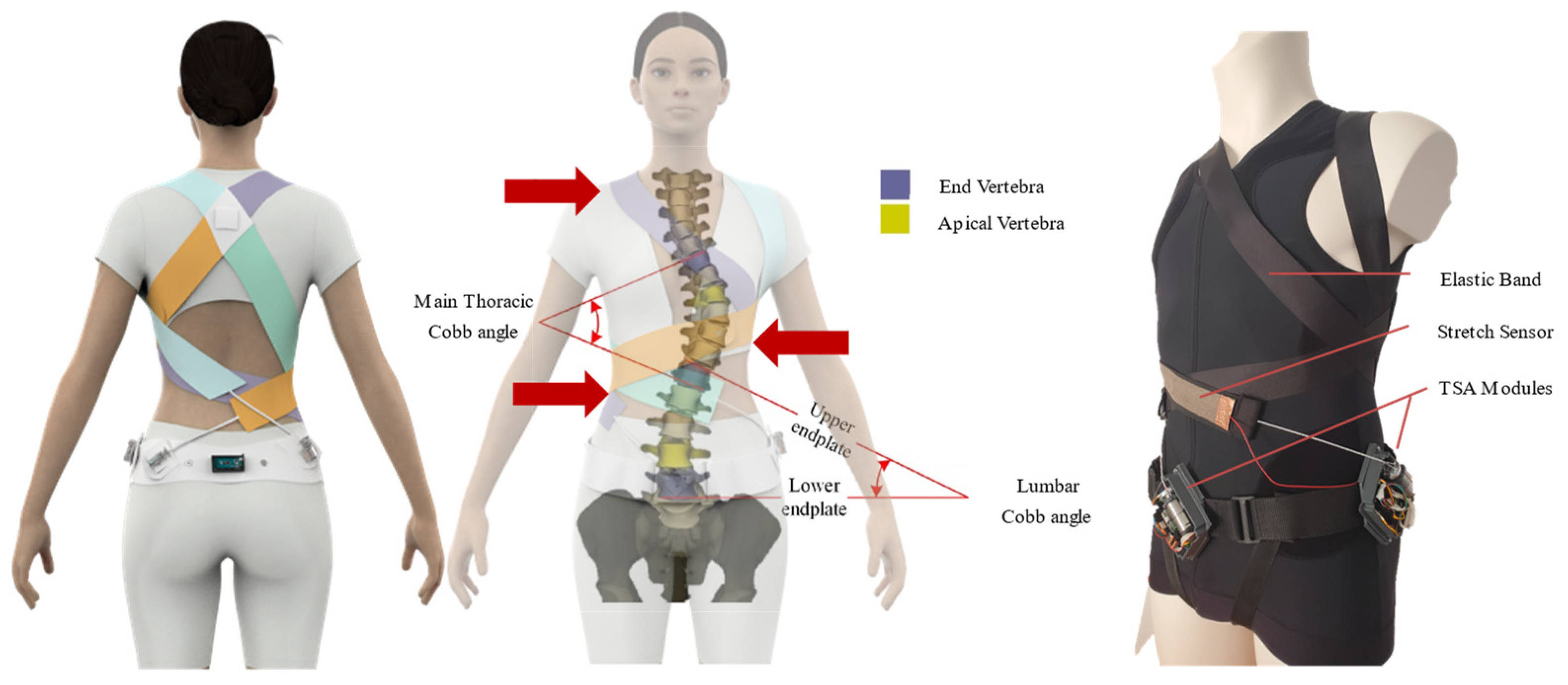 TIKE Scoliosis Brace Posture Corrector Treatment Adjustable Spinal ...