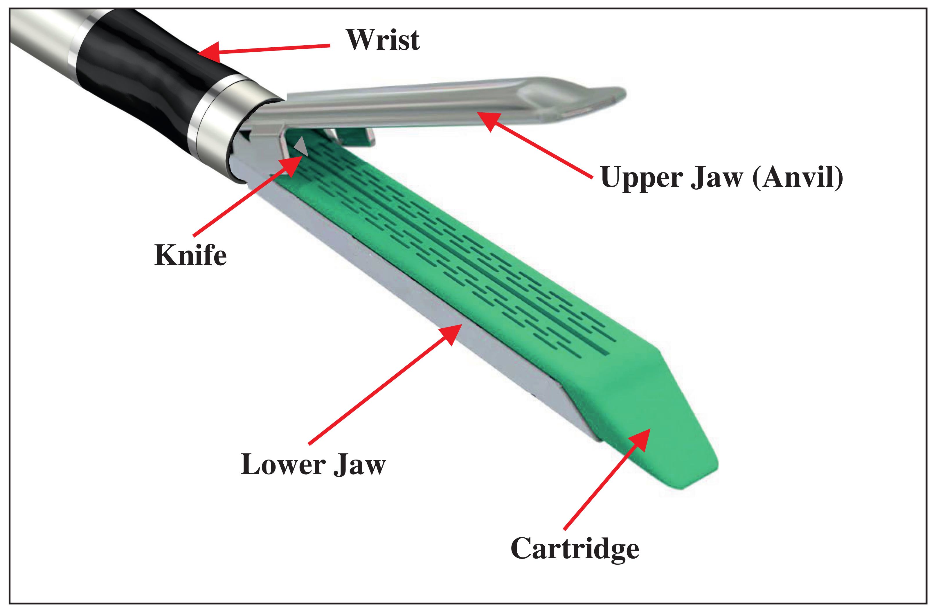 Robotics Free FullText Surgical Staplers in Laparoscopic Colectomy