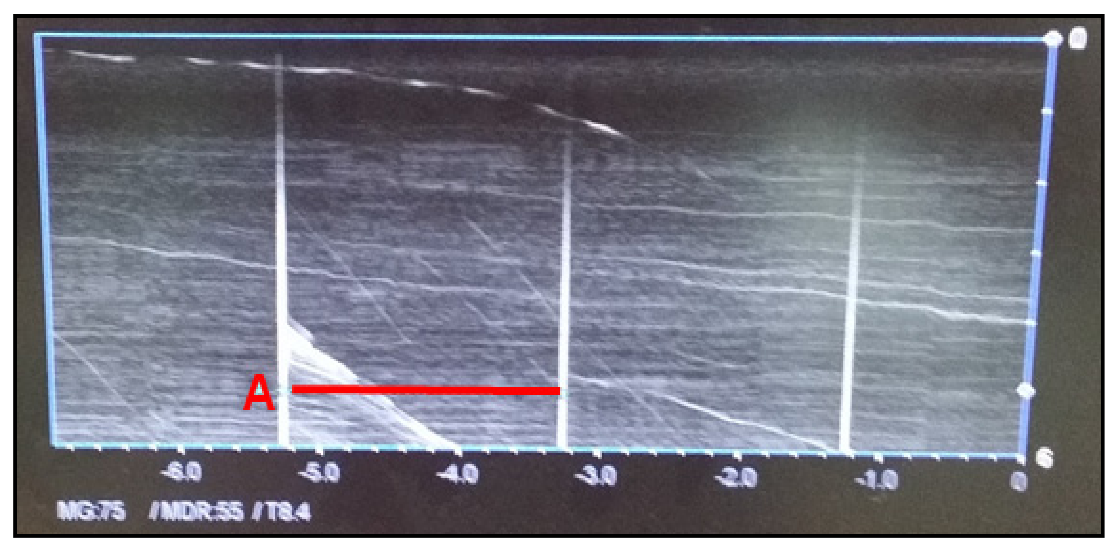 Safety 07 00031 g006