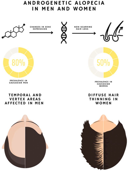 Androgenic Alopecia Marketed And Pipeline Drugs Effectiveness of Platelet-Rich Plasma in the Treatment of Androgenic