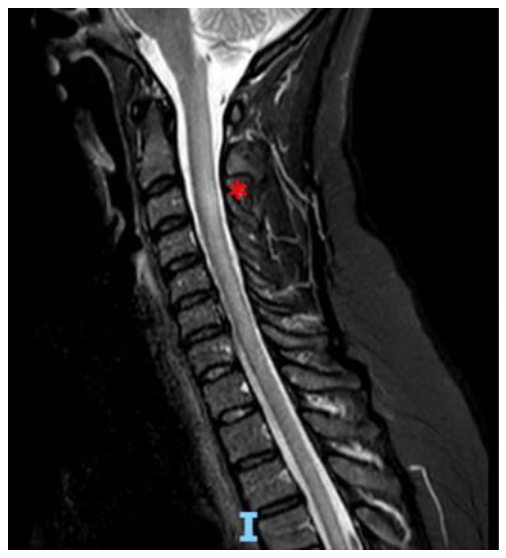 Sclerosis 01 00007 g001