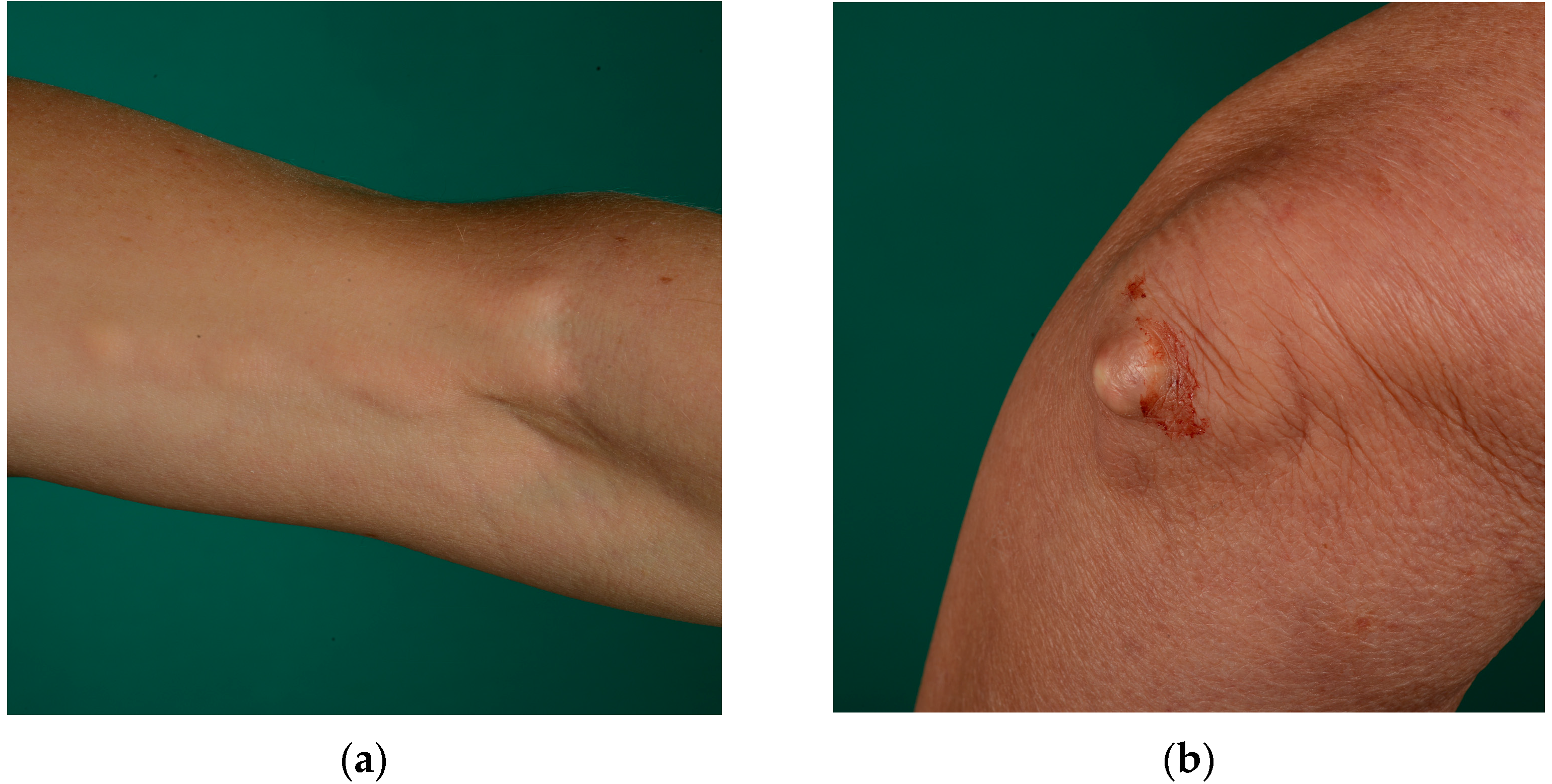 Sclerosis 02 00019 g001