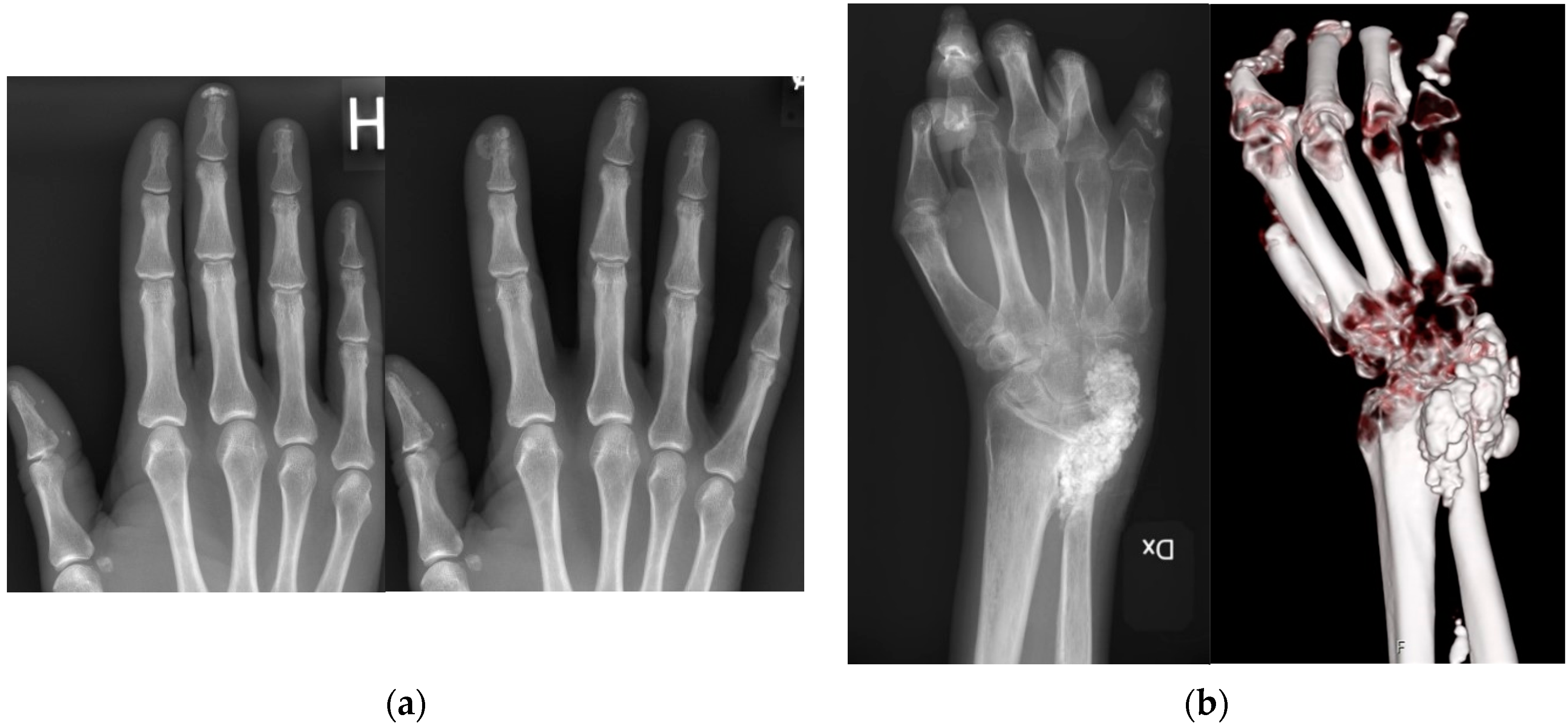 Sclerosis 02 00019 g002