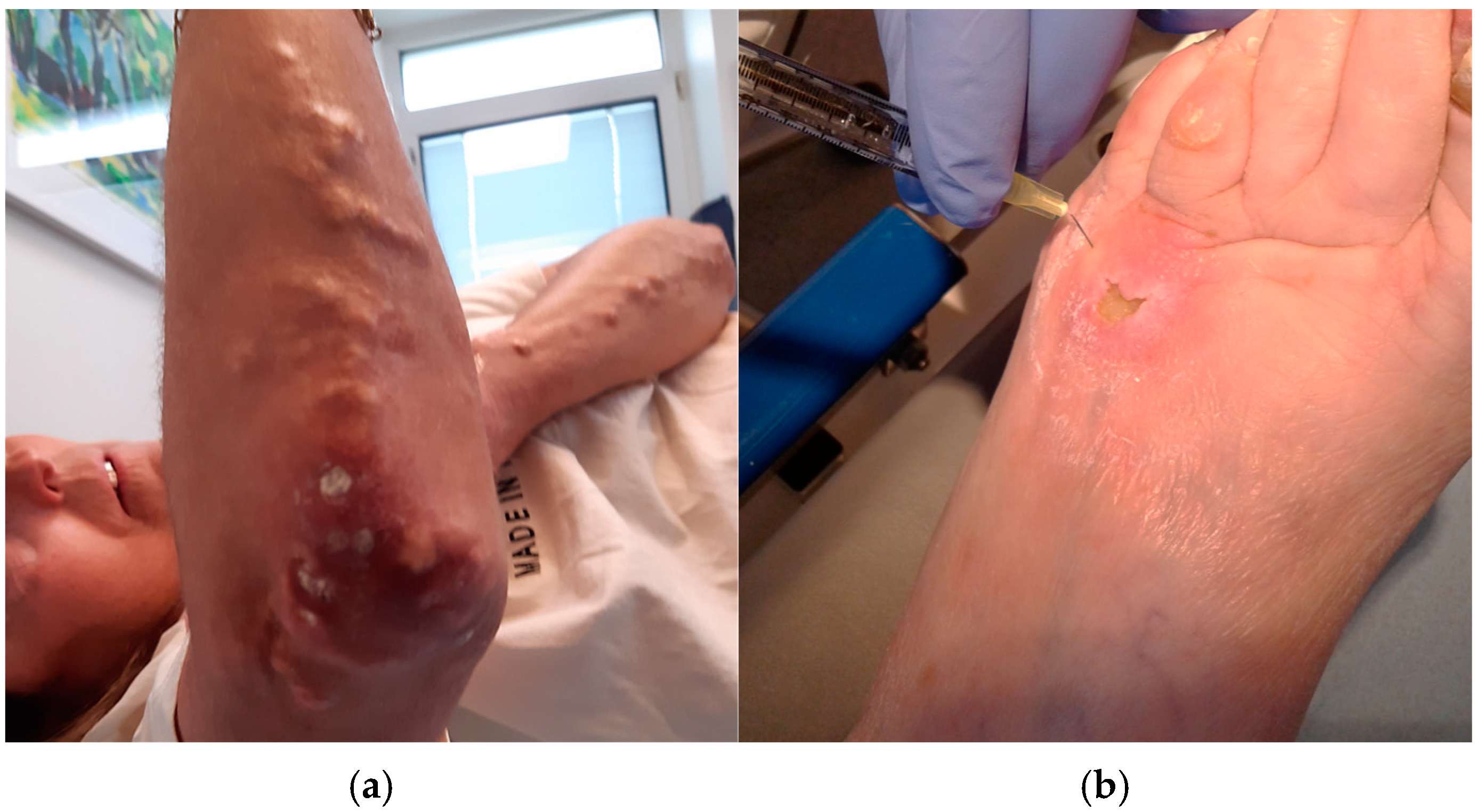 Sclerosis 02 00019 g003