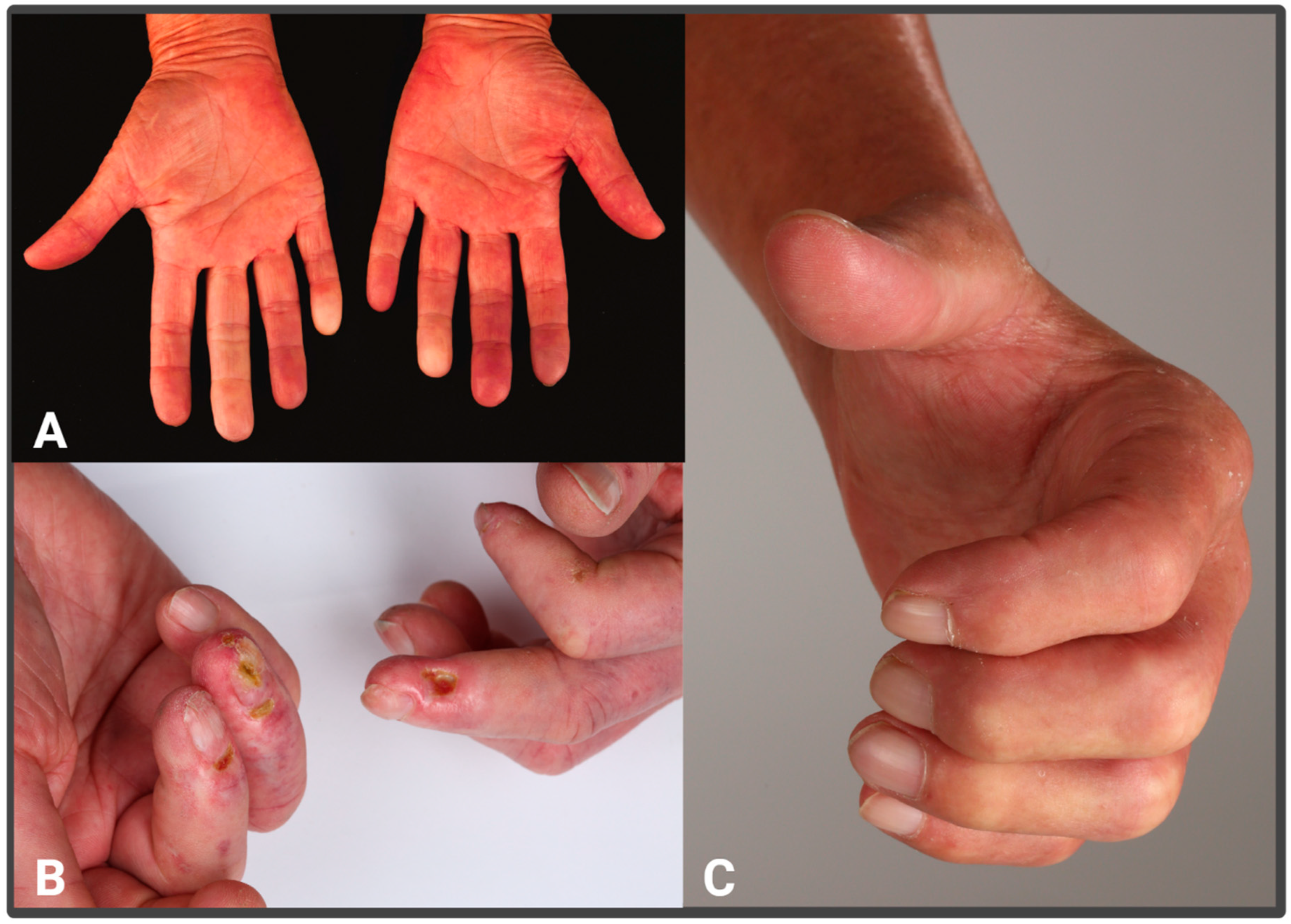 Sclerosis 03 00017 g001 Sclerosis 03 00017 g001