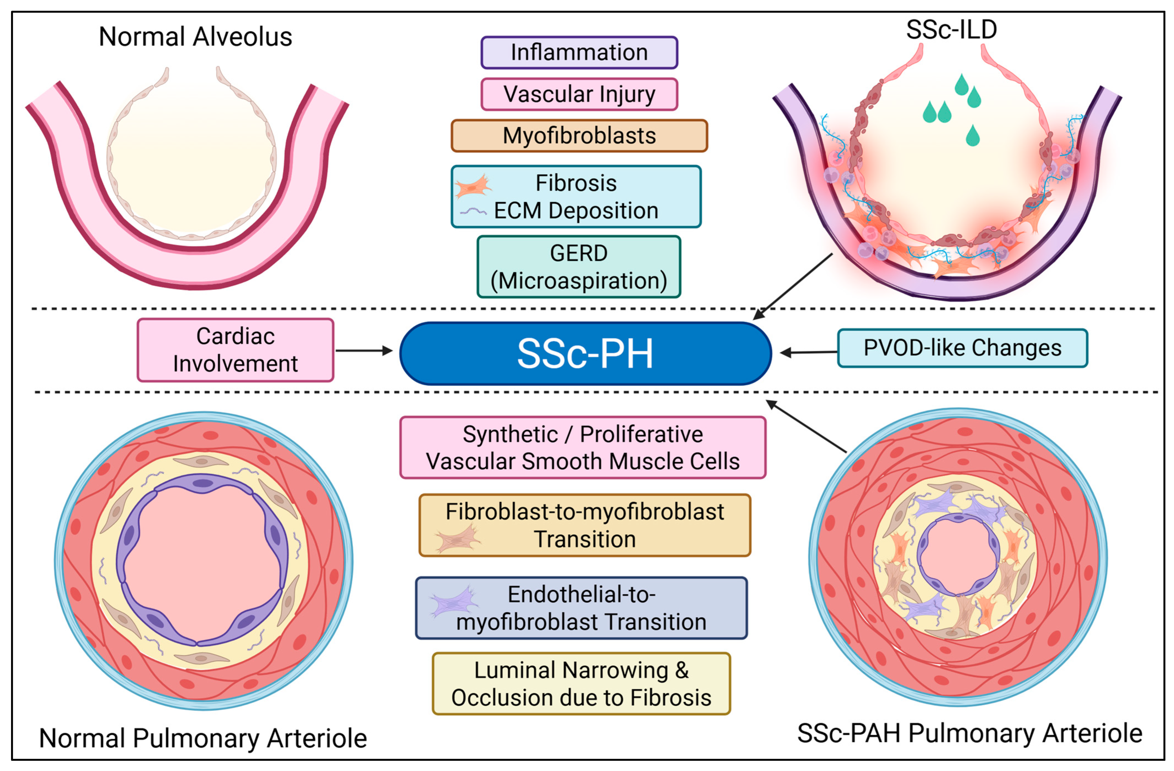 Sclerosis 03 00020 g004 Sclerosis 03 00020 g004