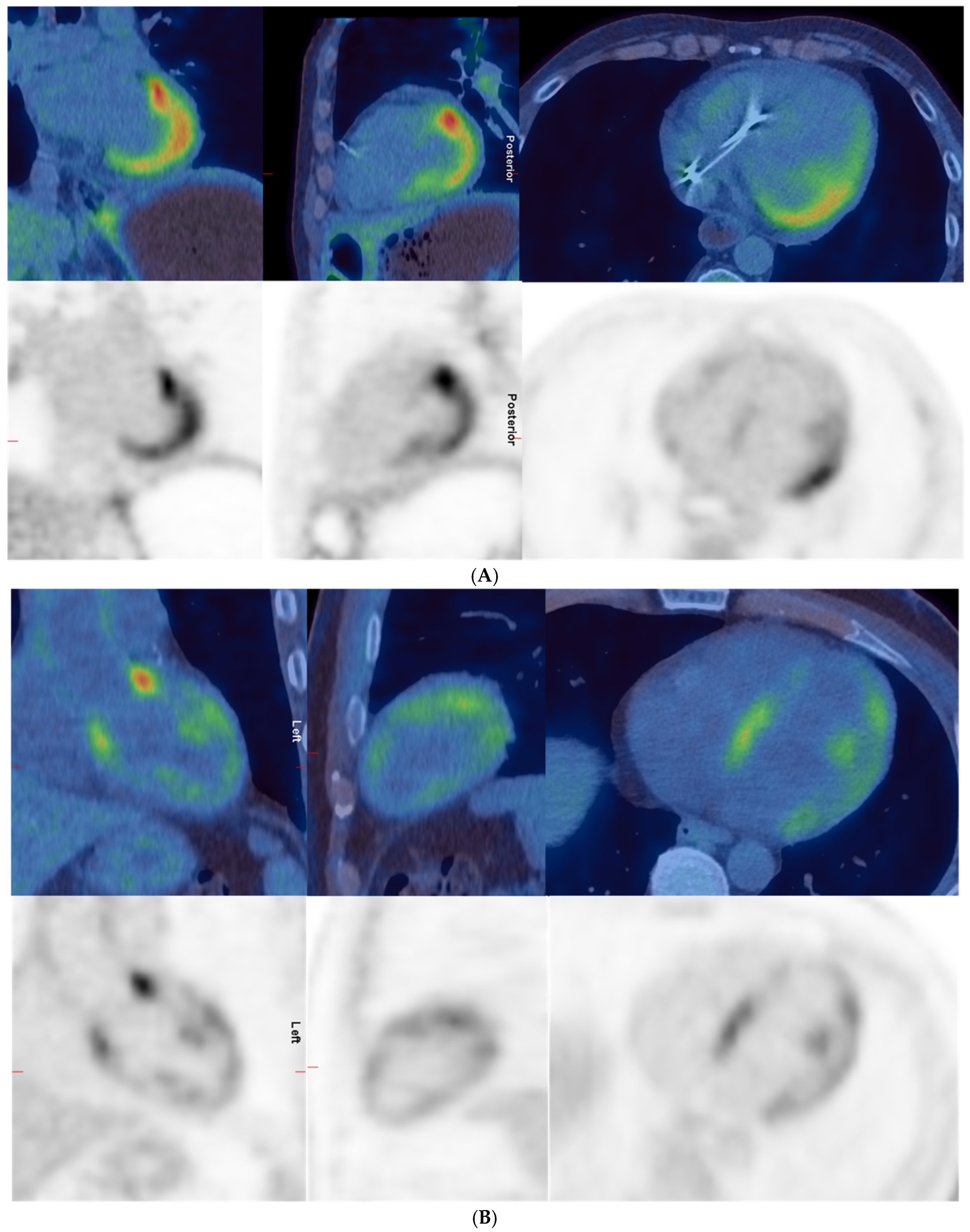 Sclerosis 03 00031 g002 Sclerosis 03 00031 g002