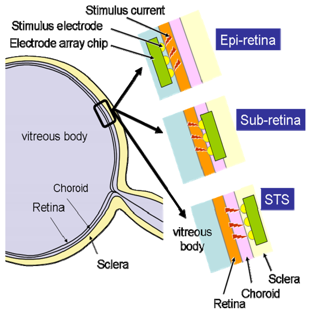 Sensors 09 09073f6 1024