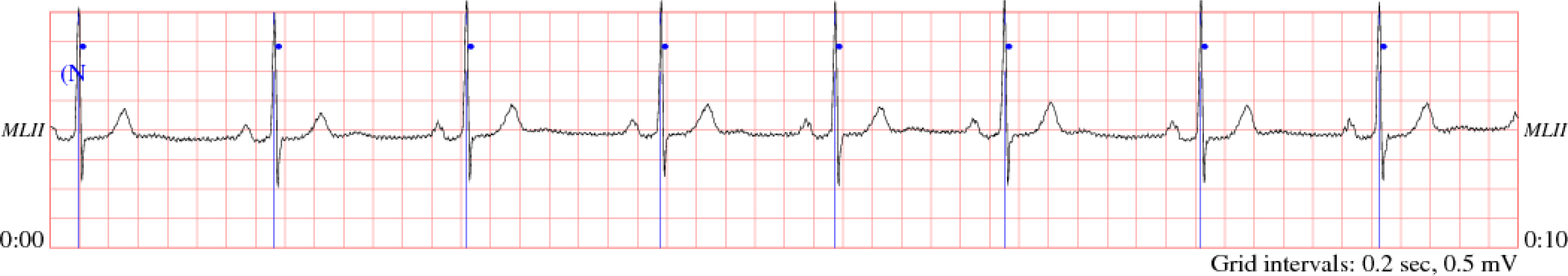Sensors 10 03243f9 1024