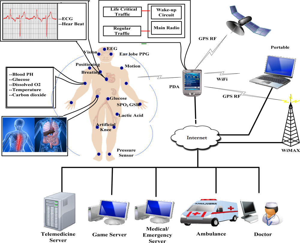 Sensors 11 03717f1 1024