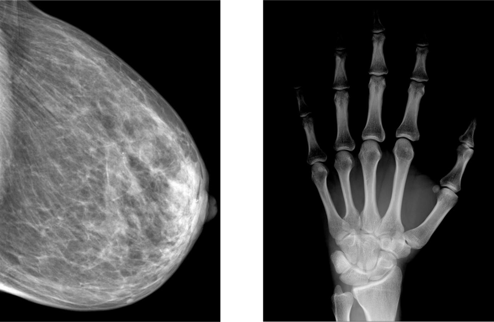 Sensors 11 05112f4 1024