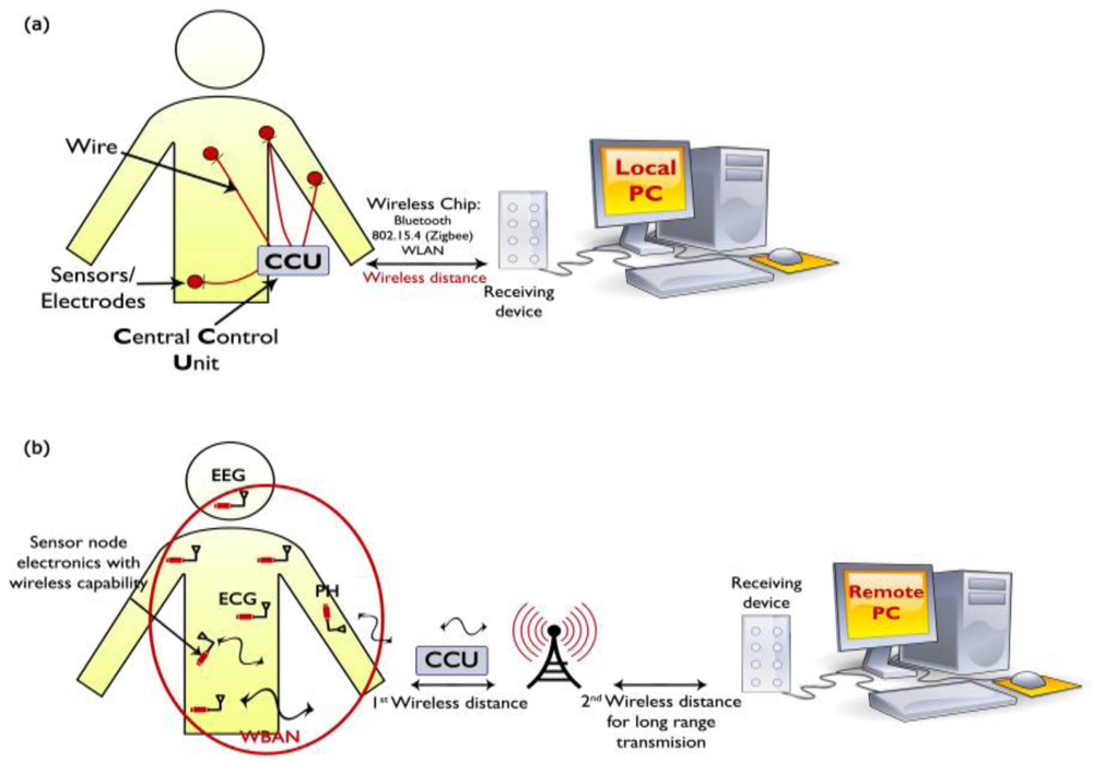 Sensors Free FullText Wearable and Implantable Wireless Sensor