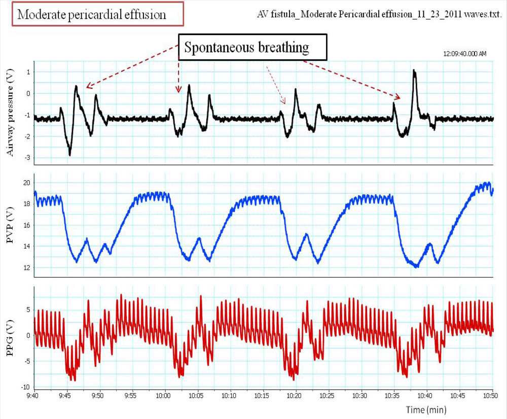 Sensors 12 02236f4 1024
