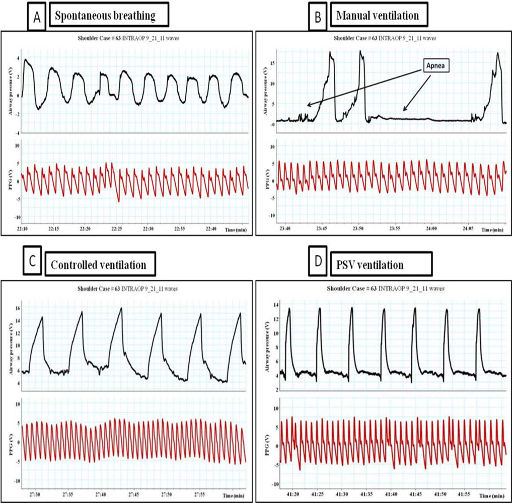 Sensors 12 02236f6 1024