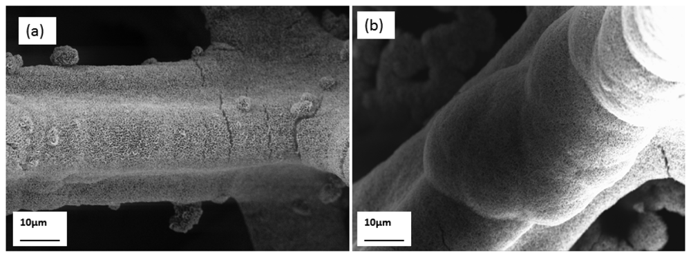 Potentiometric Zinc Ion Sensor Based on Honeycomb-Like NiO