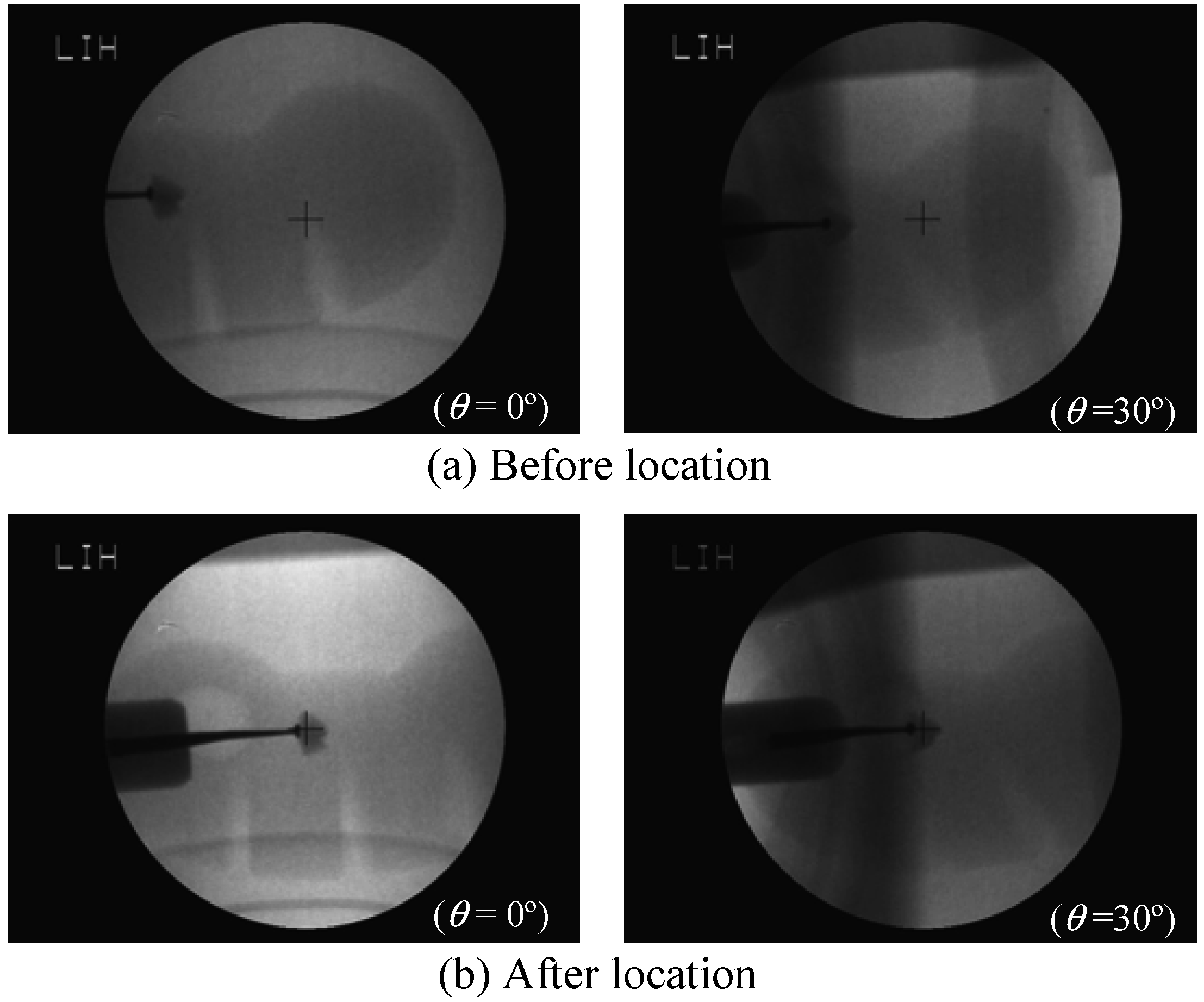 Sensors 13 01319 g007 550