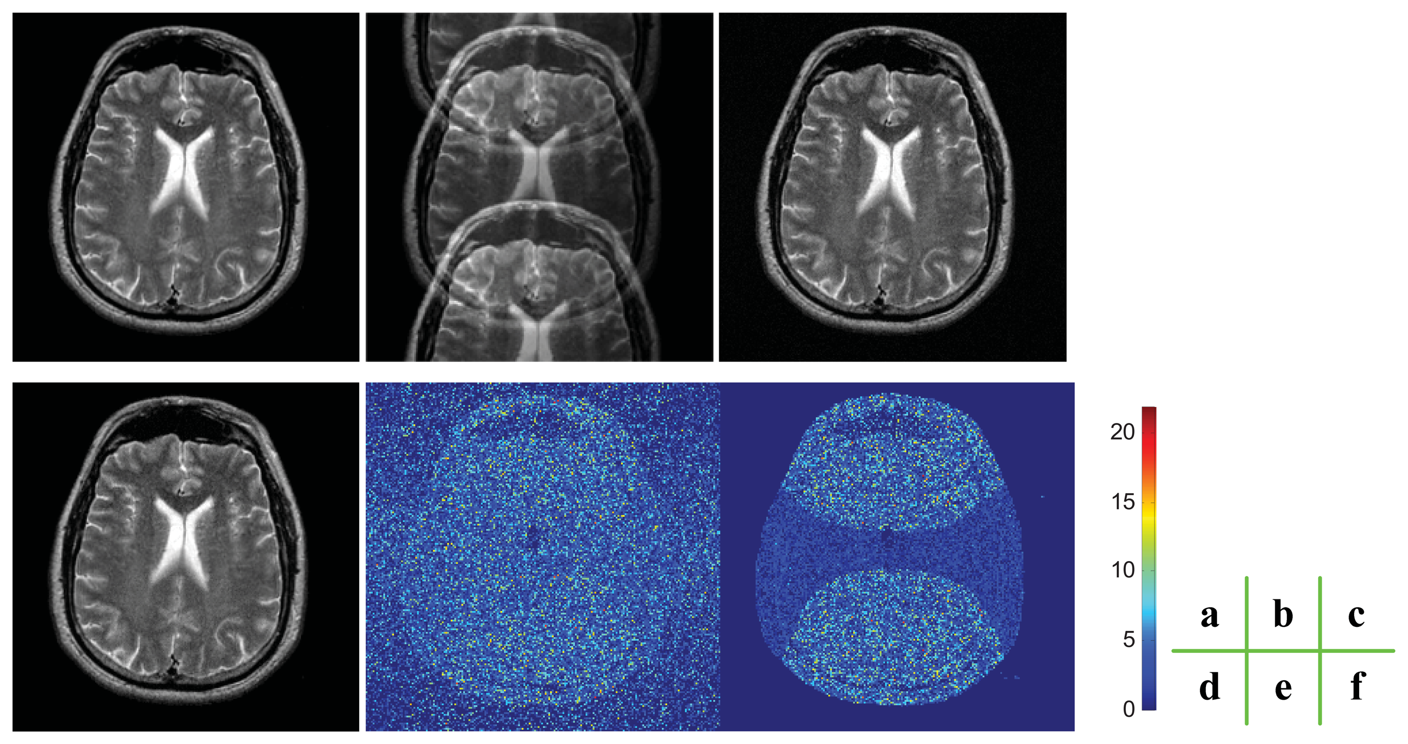A Support-Based Reconstruction for SENSE MRI