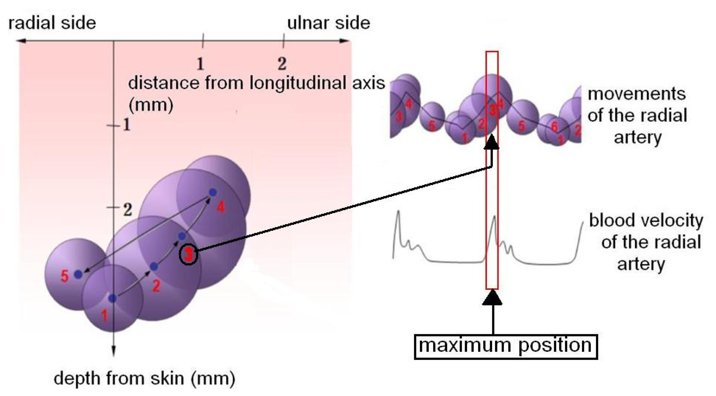 Sensors Free FullText Measurement of Spatial Pulse Wave Velocity