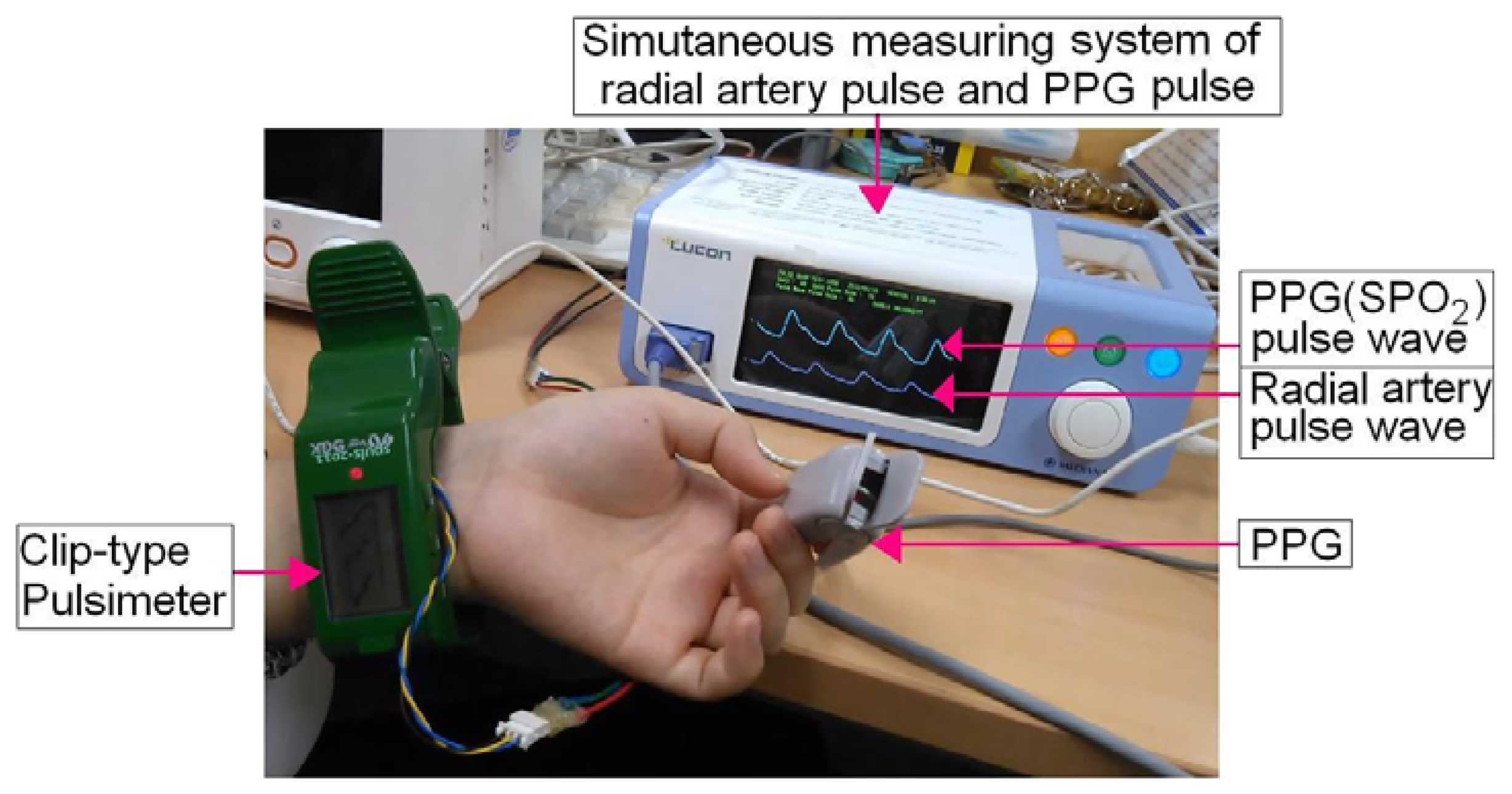 Sensors Free FullText Measurement of Spatial Pulse Wave Velocity