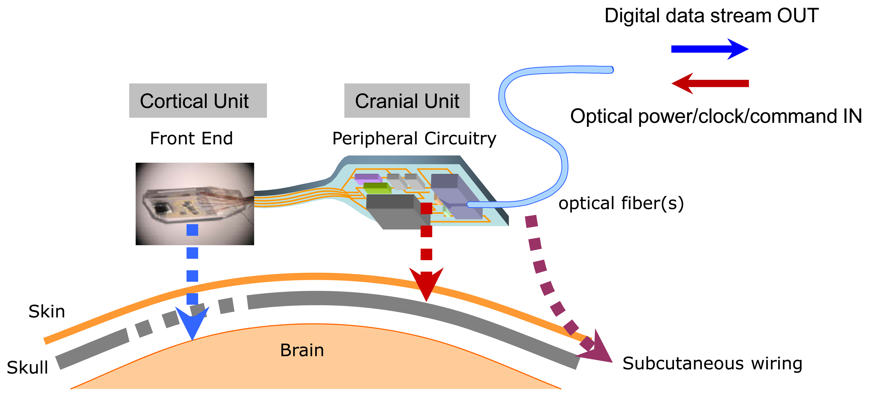 Sensors Free FullText An Implantable Neural Sensing Microsystem