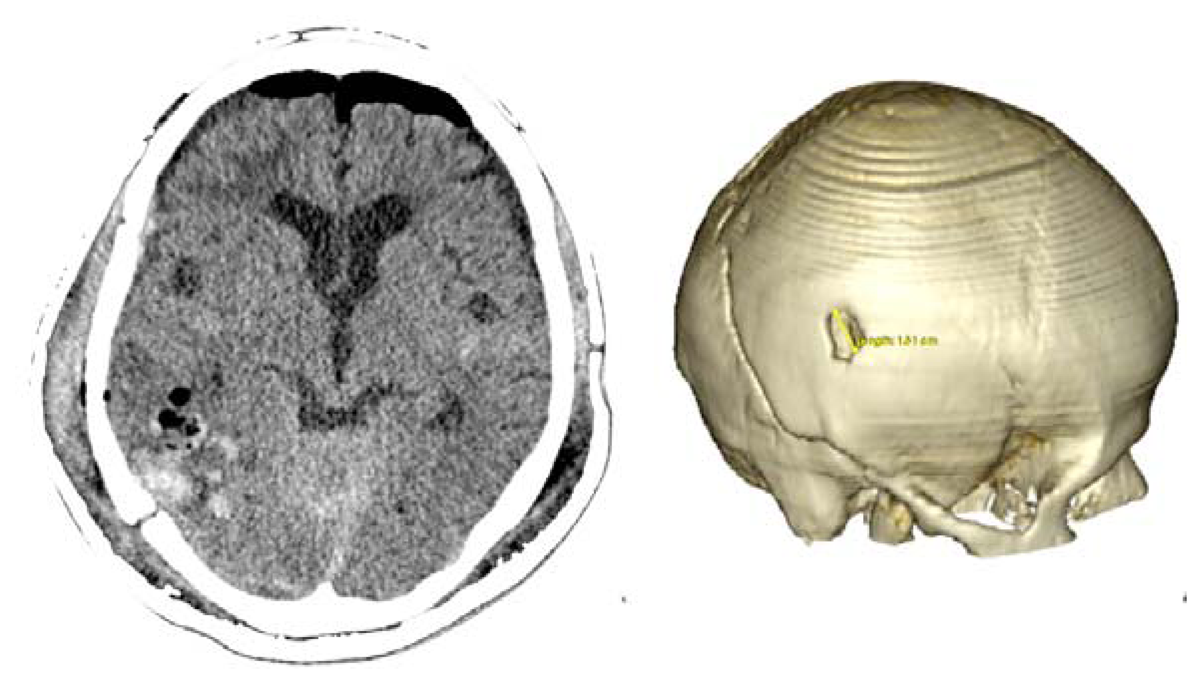 Sensors 13 06477f6 1024