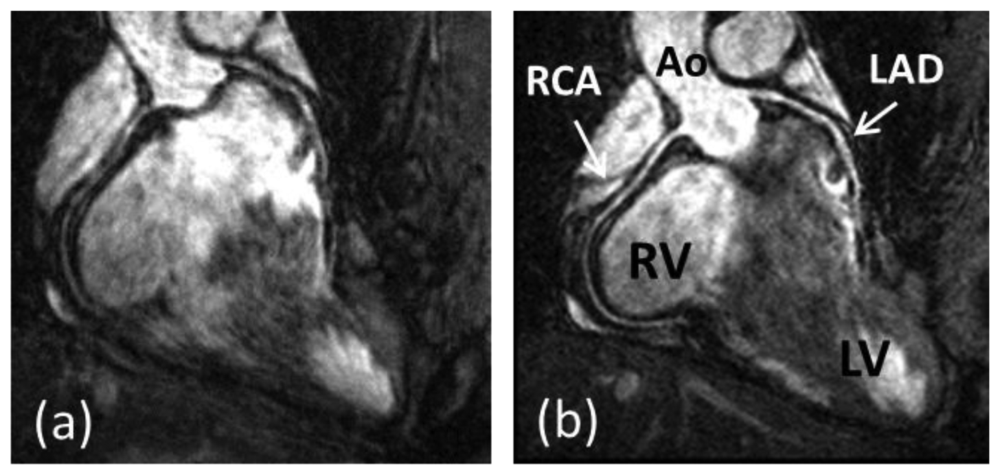 Sensors 13 06882f1 1024