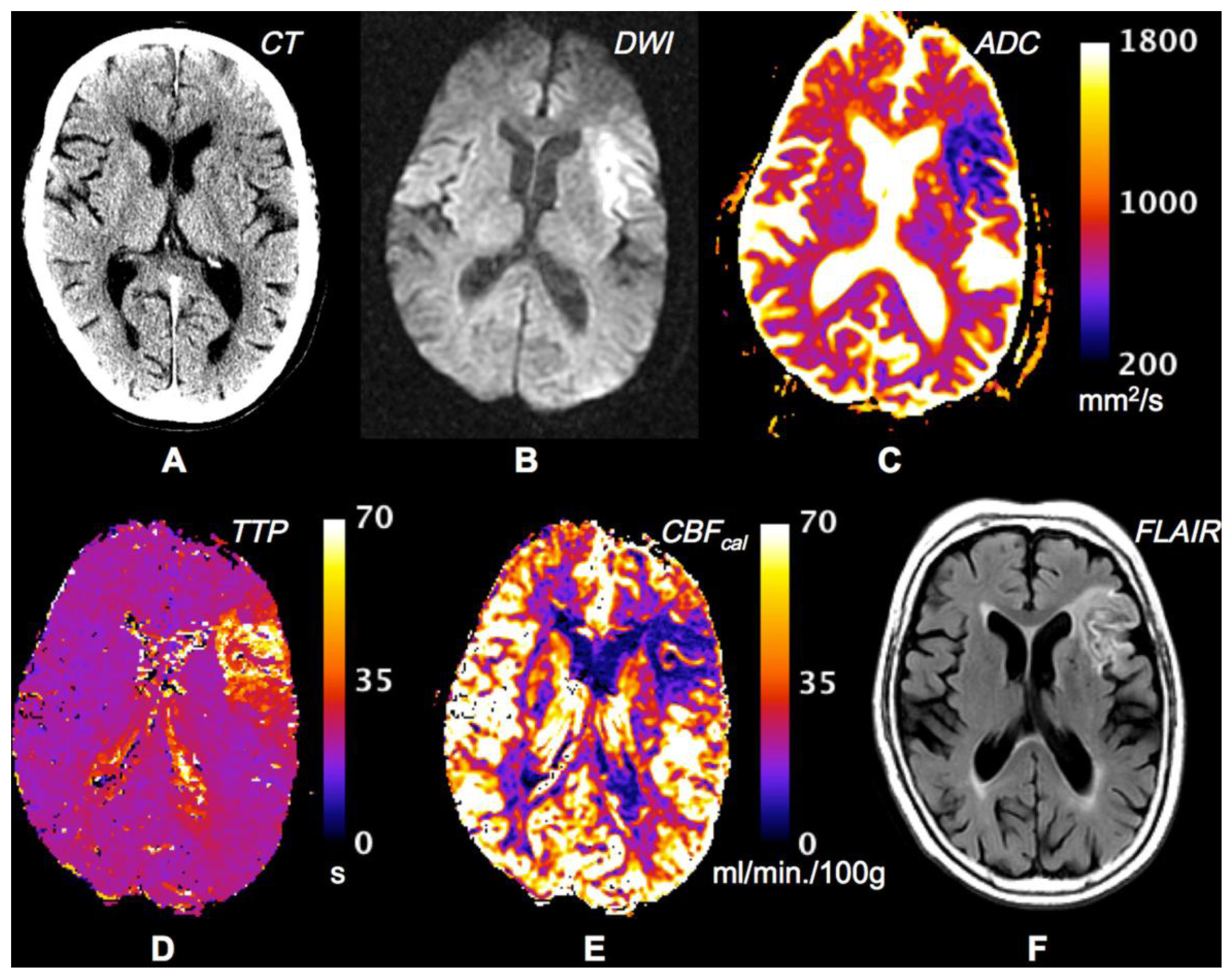 Sensors 13 06981f3 1024