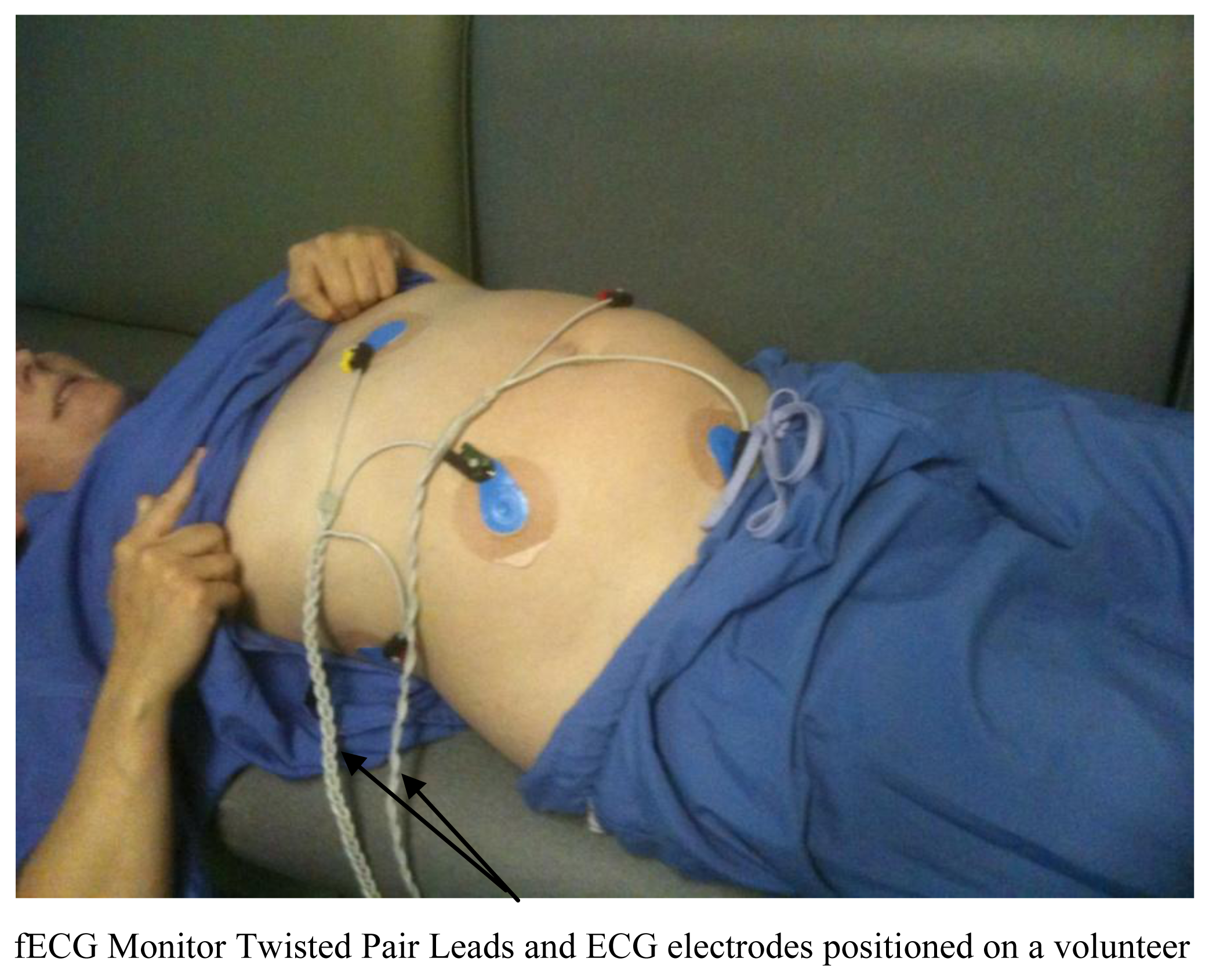 Sensors 13 11271f1 1024