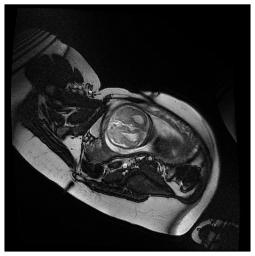 Sensors 13 11271f7 1024