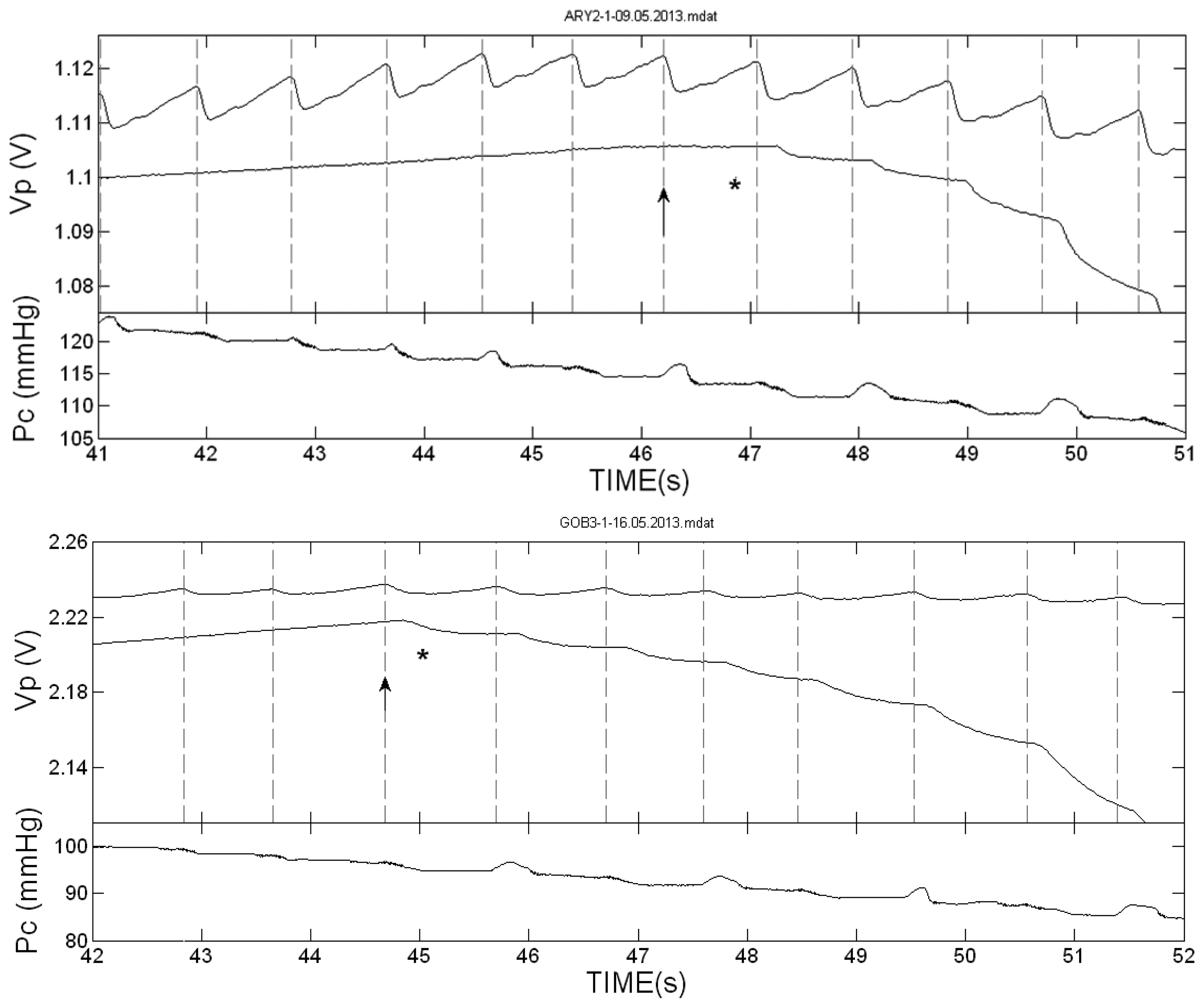 Sensors 13 14797f2 1024