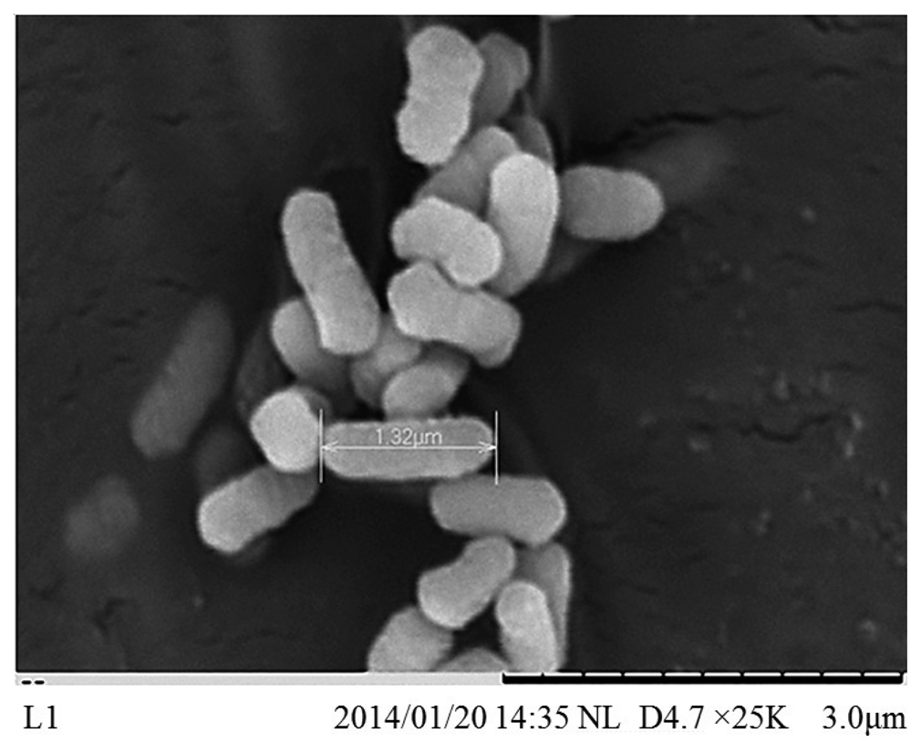 Enterobacter asburiae