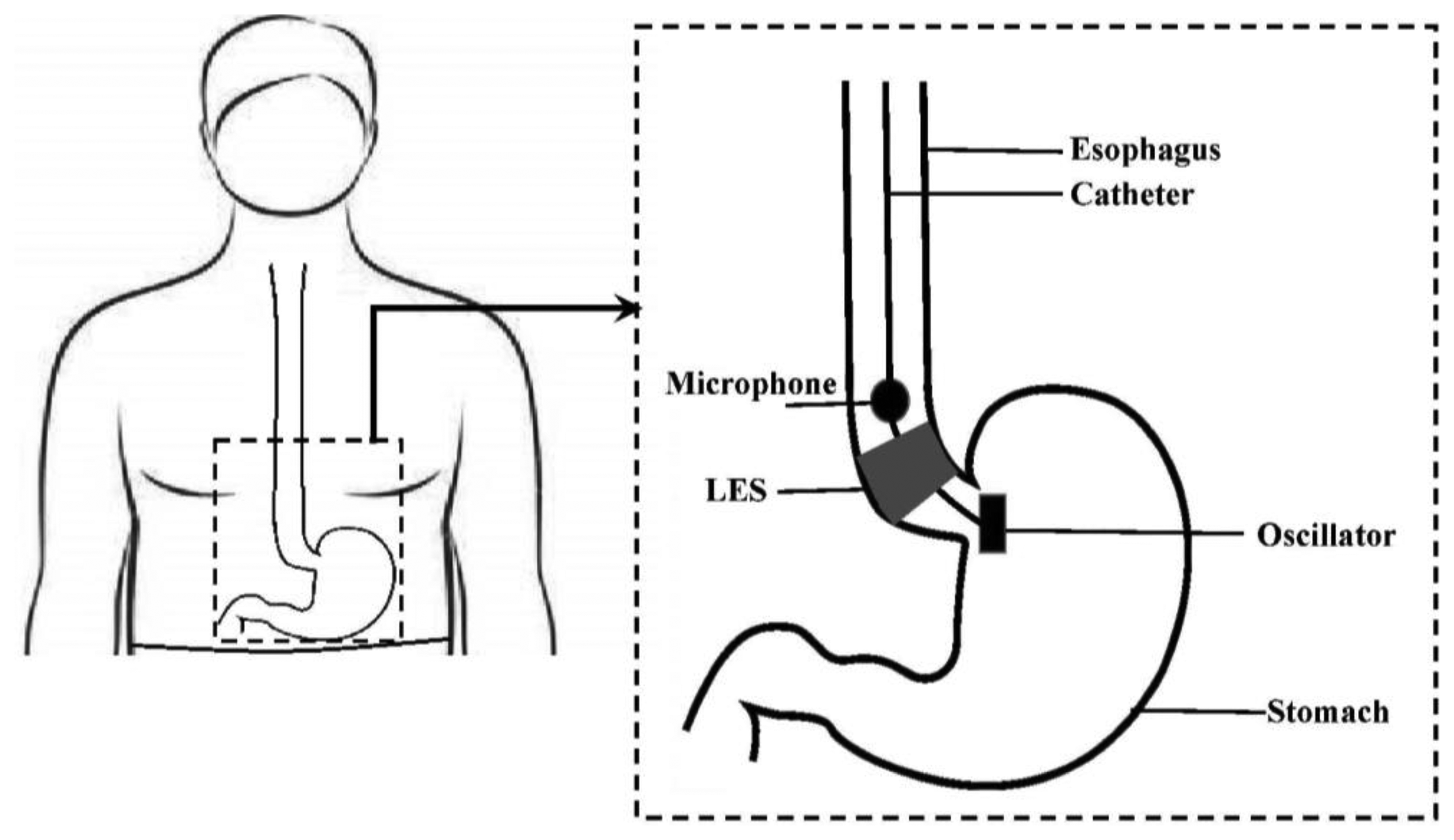 Sensors 14 14700f1 1024