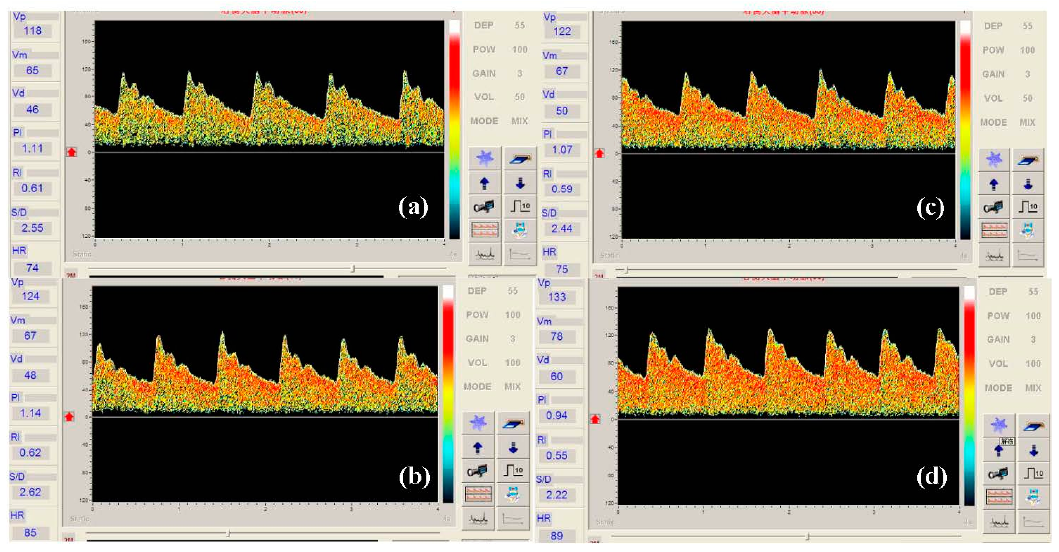 Sensors 14 24462f6 1024