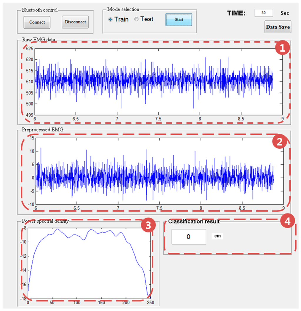 Sensors | Free Full-Text | A Real-Time Pinch-to-Zoom Motion Detection ...