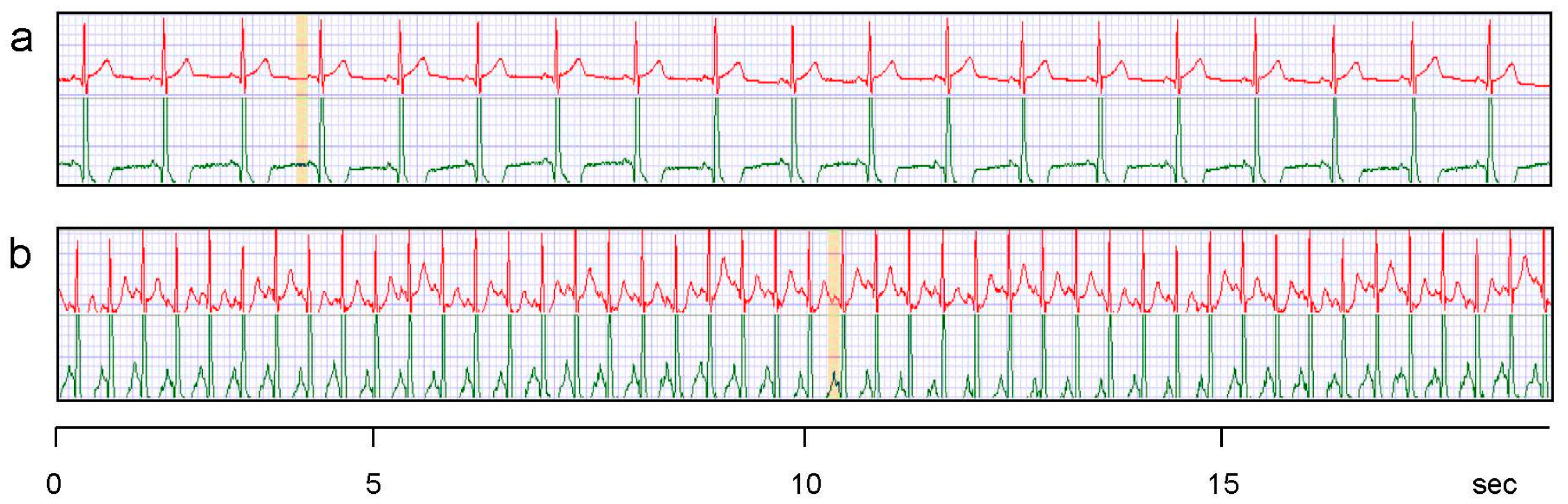 Sensors 15 01750f6 1024