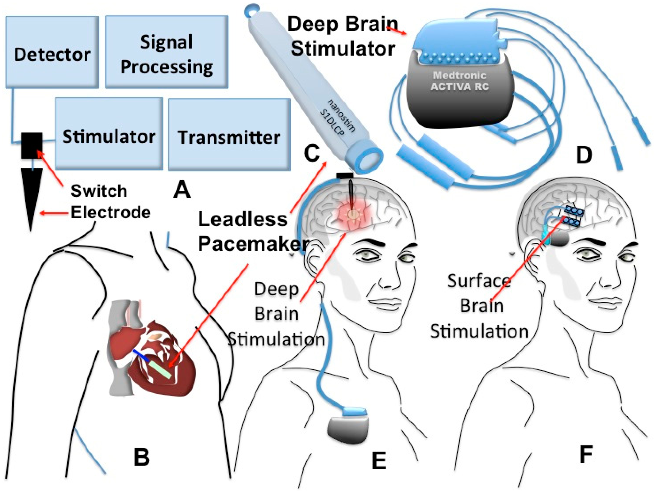 Sensors 15 03236f2 1024