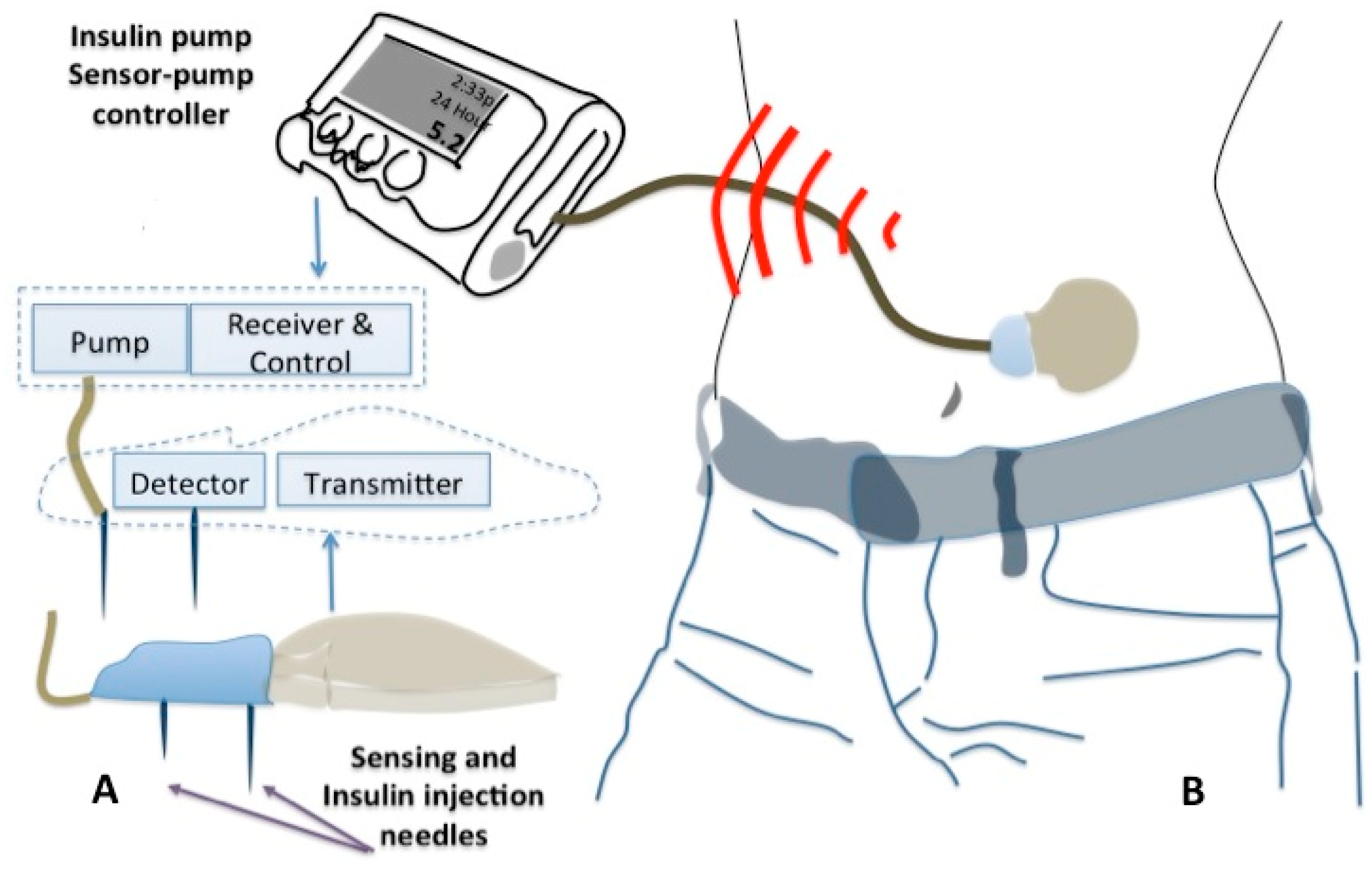 Sensors 15 03236f3 1024