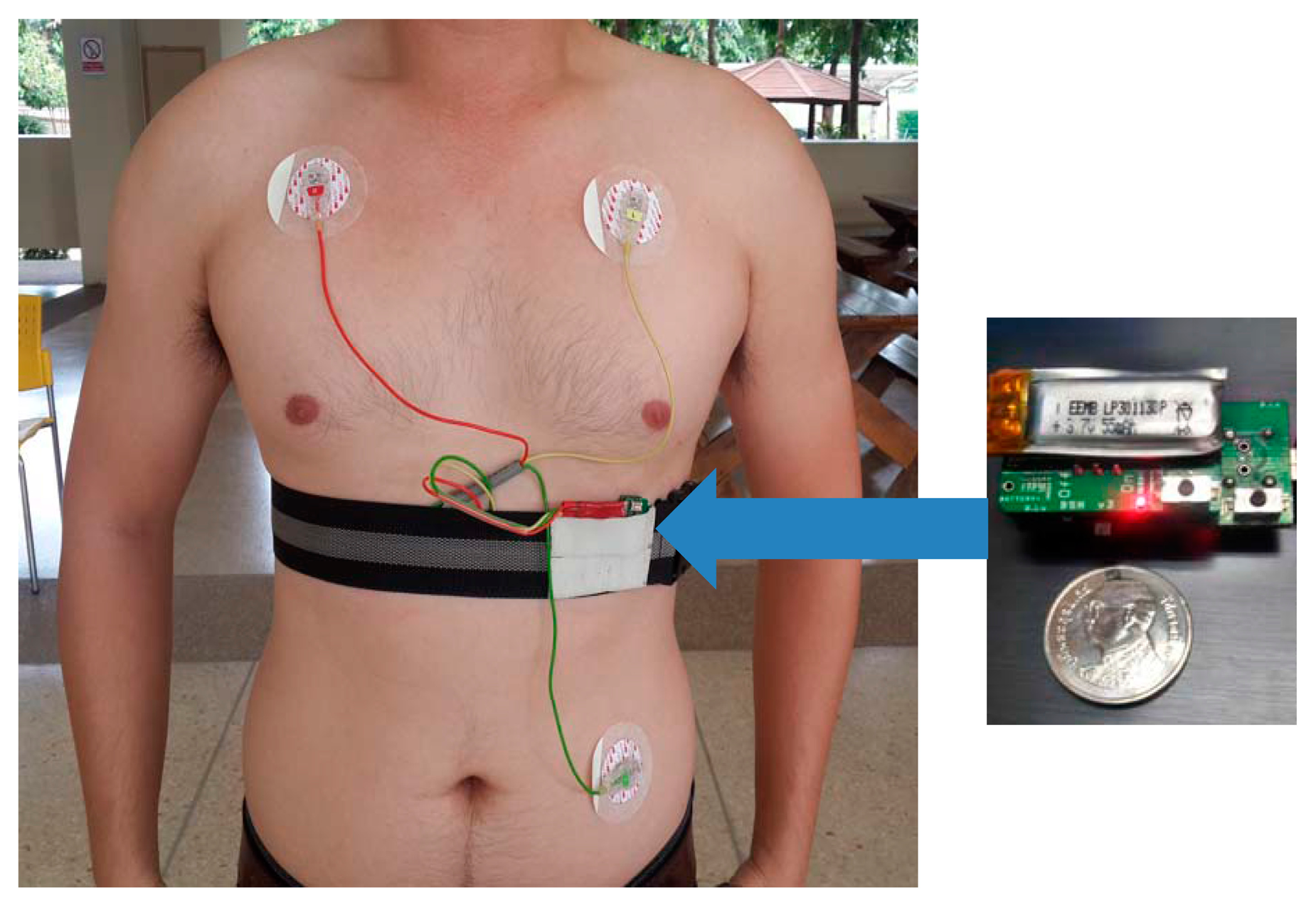 Sensors 15 03952f1 1024