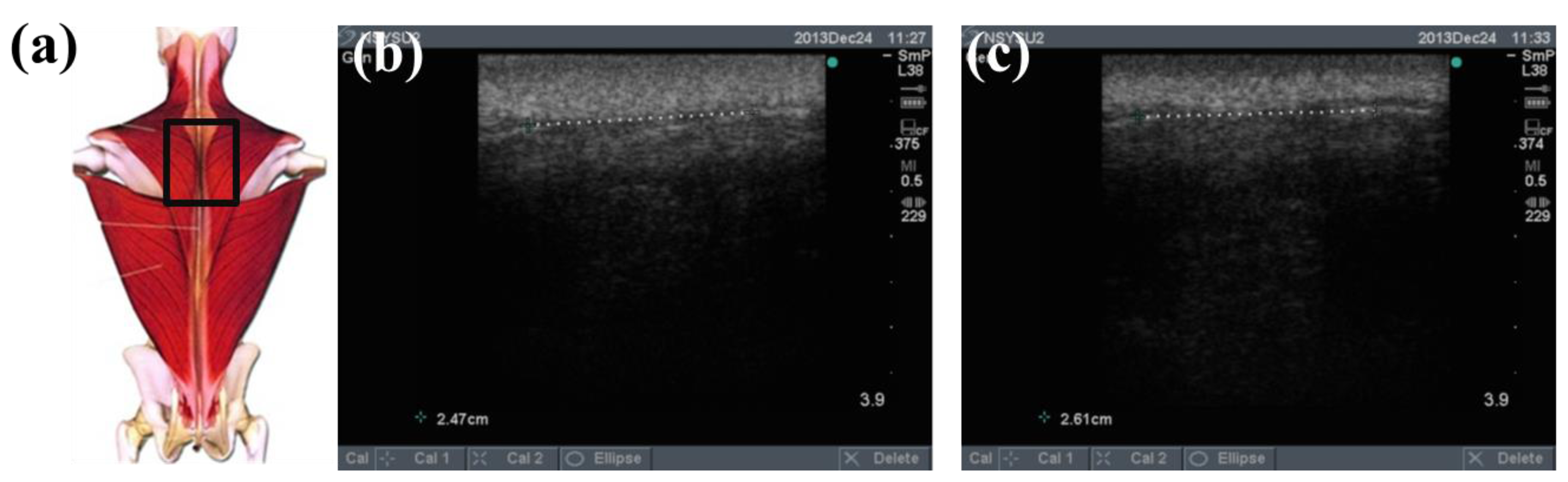 Sensors 15 03975f10 1024